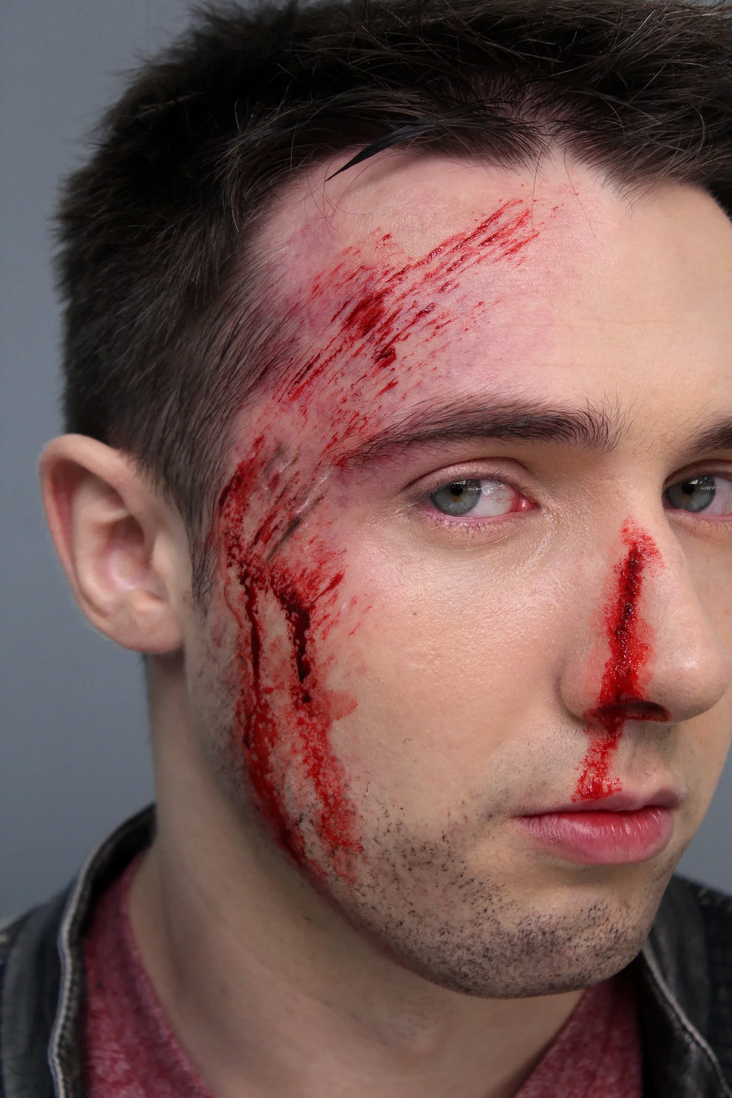 Devon_BruiseAbrasion.webp