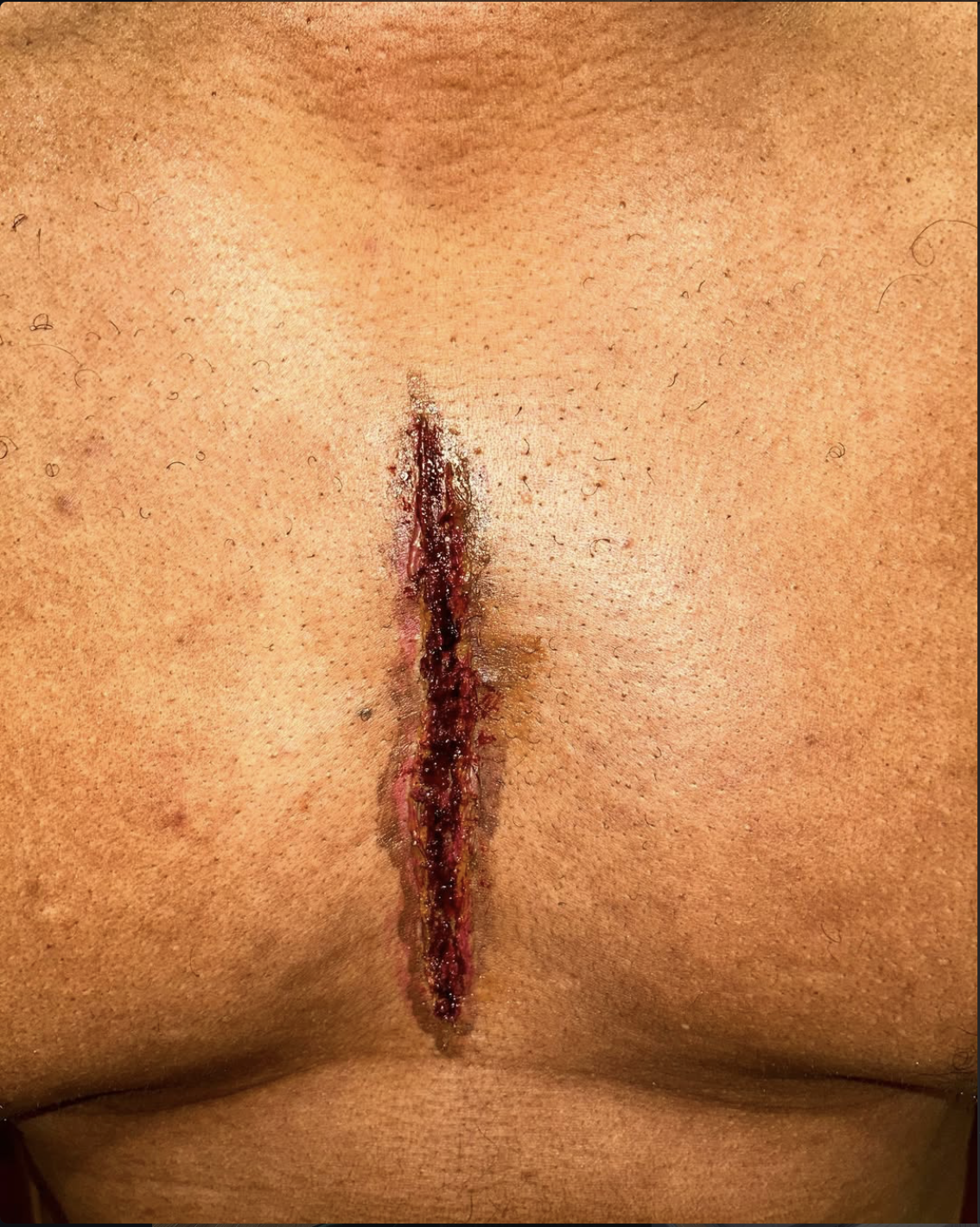 Screenshot 2026-03-04 at 5.08.26 PM.png