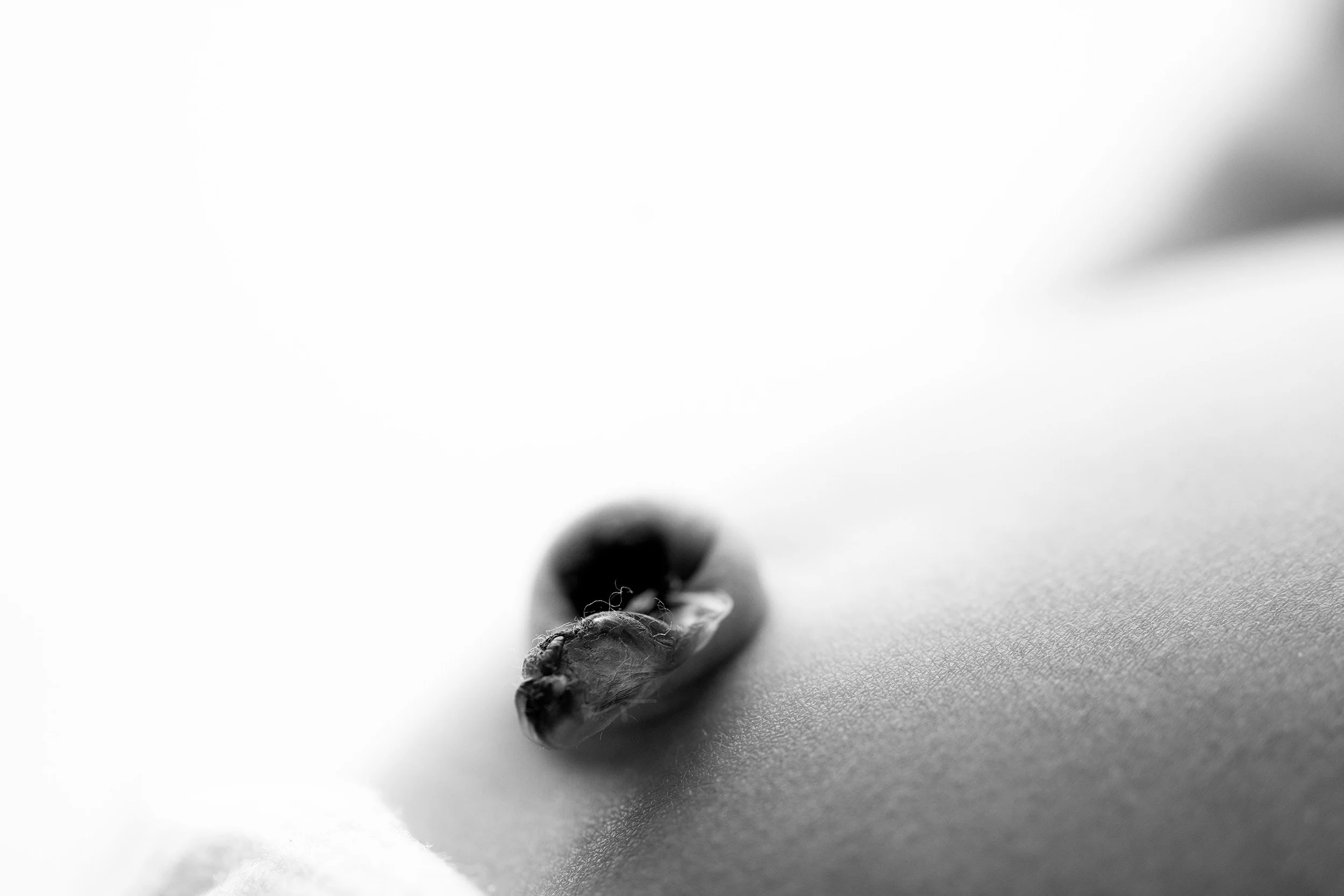 Close-up black and white photo of an umbilical cord