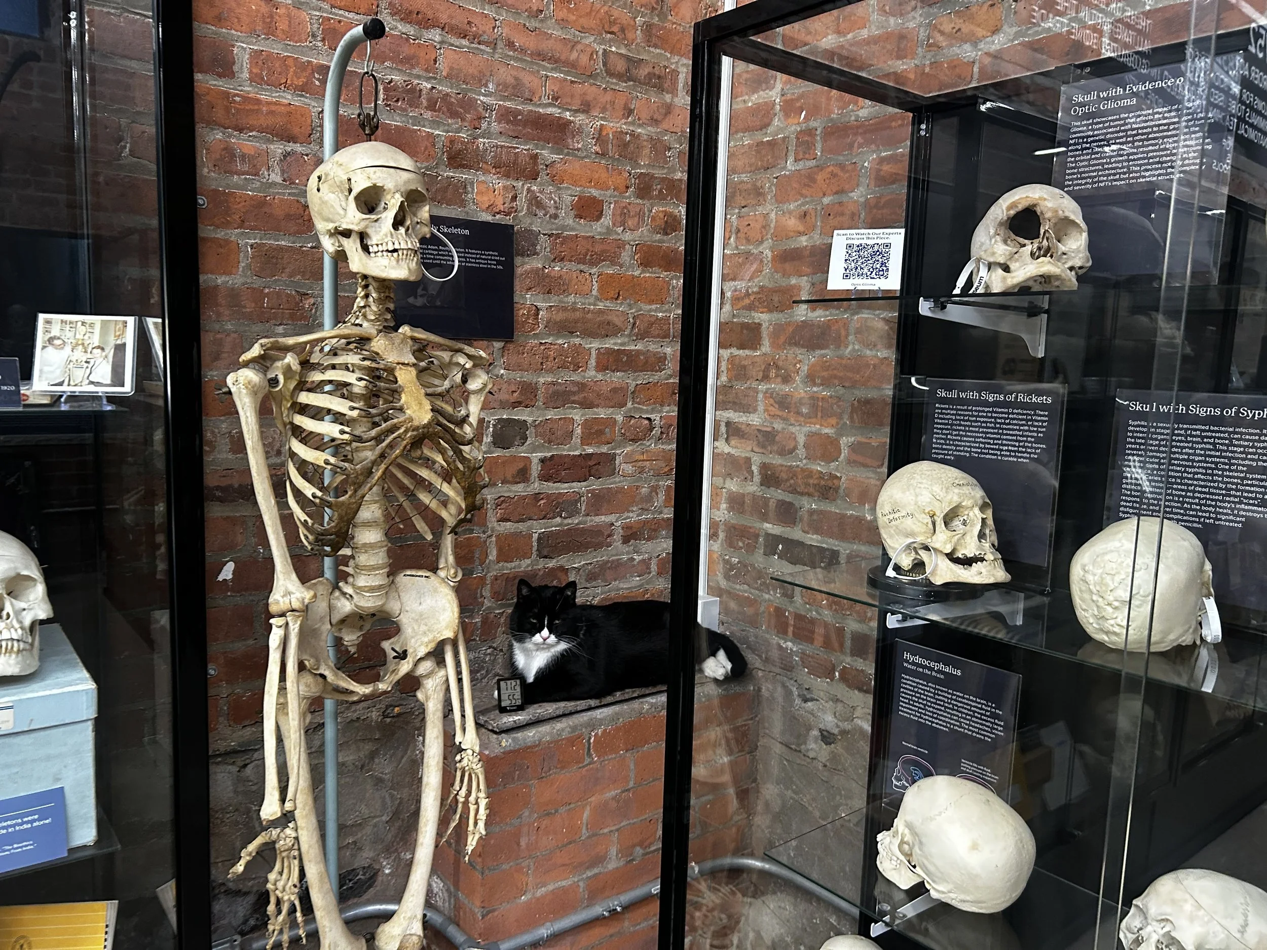 Bone Jovi — The Bone Museum