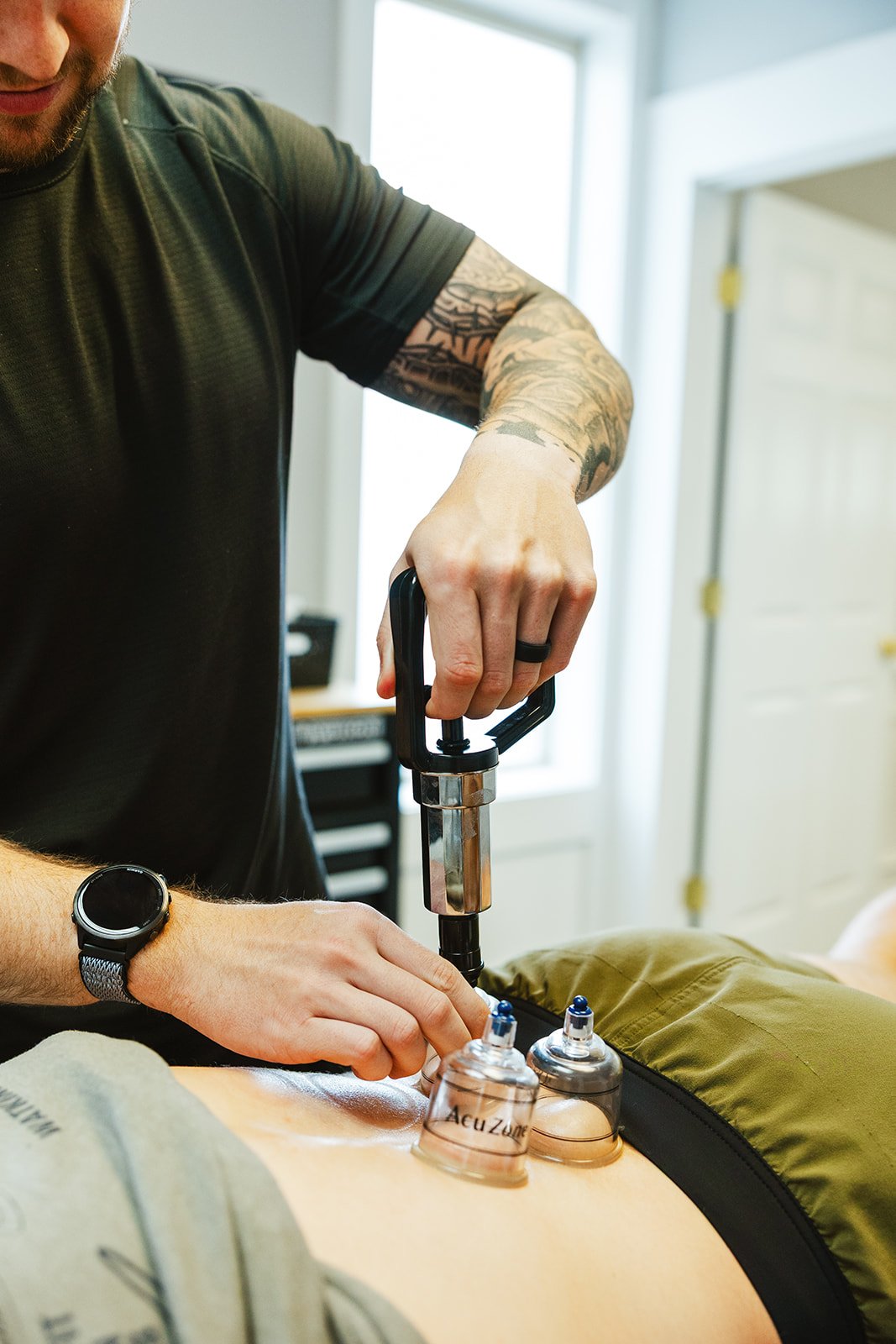 physical therapist performing cupping on adult athlete