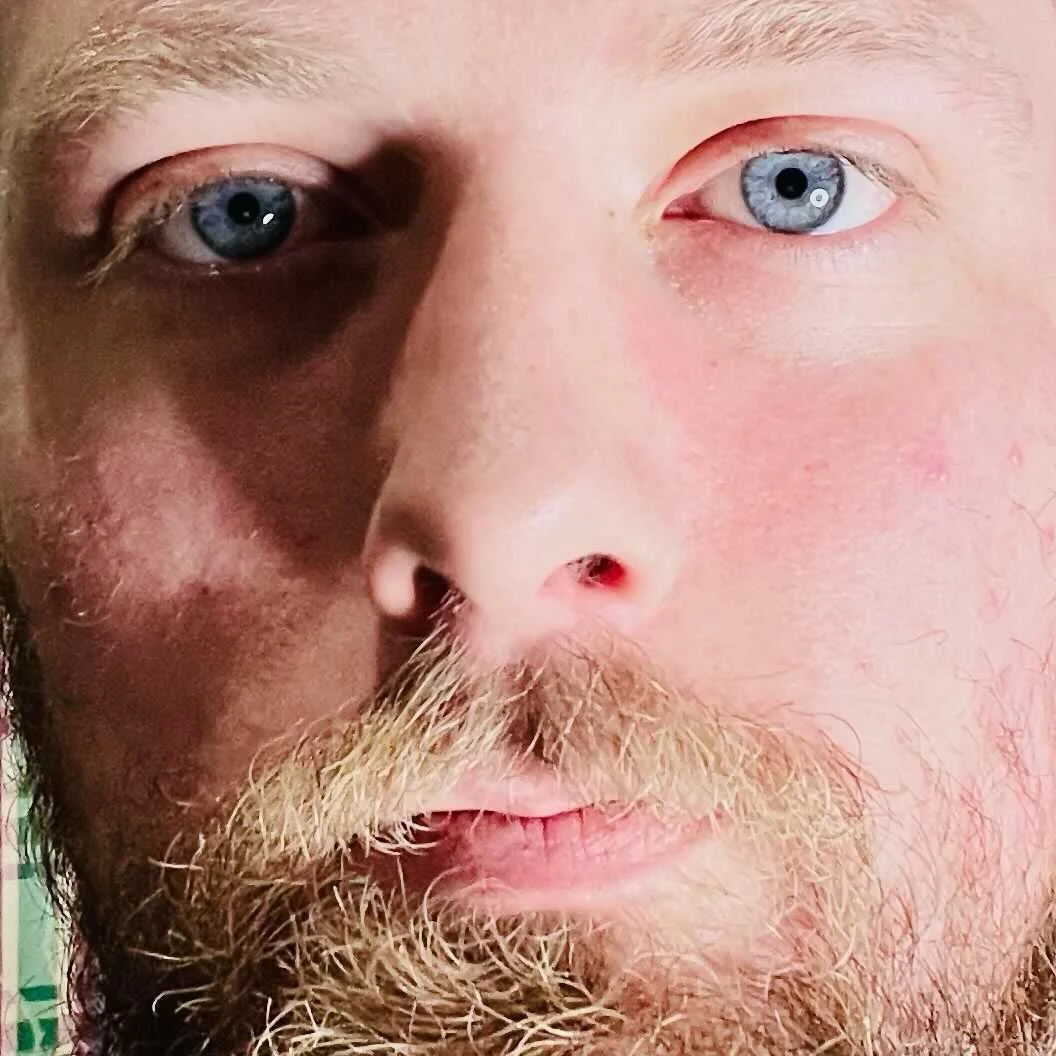 Close-up of a person's face split into two halves, showing different skin tones and eye colors.