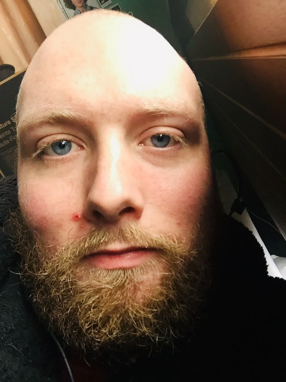 Close-up of a man with blue eyes, a reddish beard, and a small wound on his nose, lying down indoors.