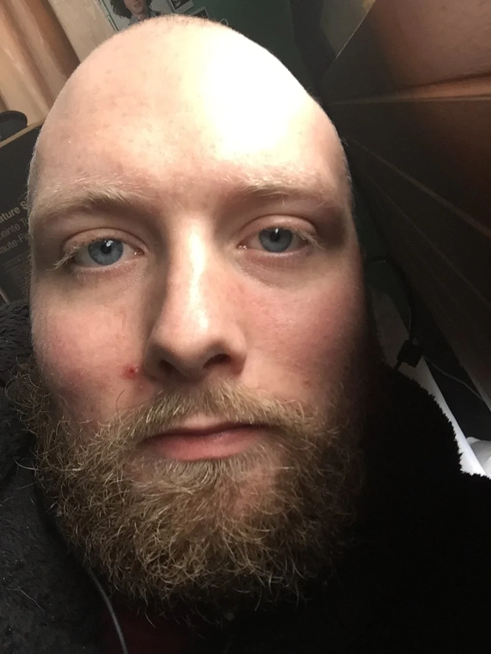 A close-up of a man with a shaved head, blue eyes, and a full beard, lying on the floor with a pimple on his nose.