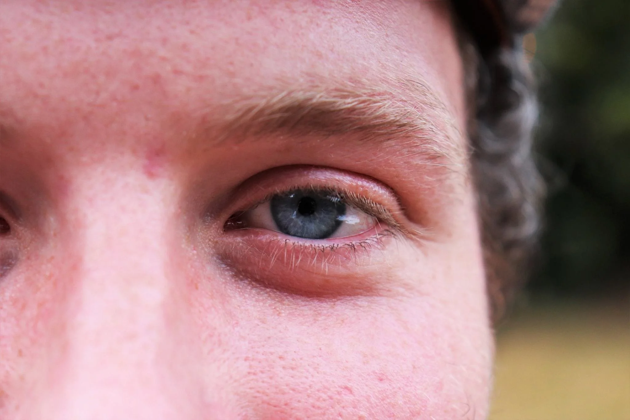 Close-up of a person's blue eye with light skin and curly brown hair partially visible.