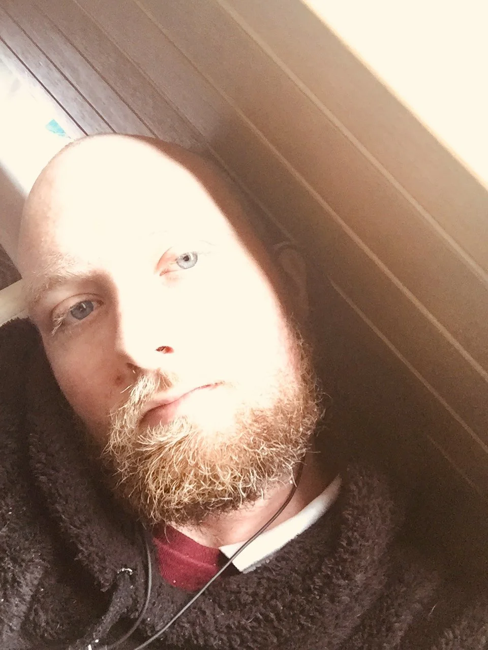 A person with a light complexion, blue eyes, a red beard, and mustache lying down on a checkered or textured brown surface, with bright sunlight overexposing part of their face.