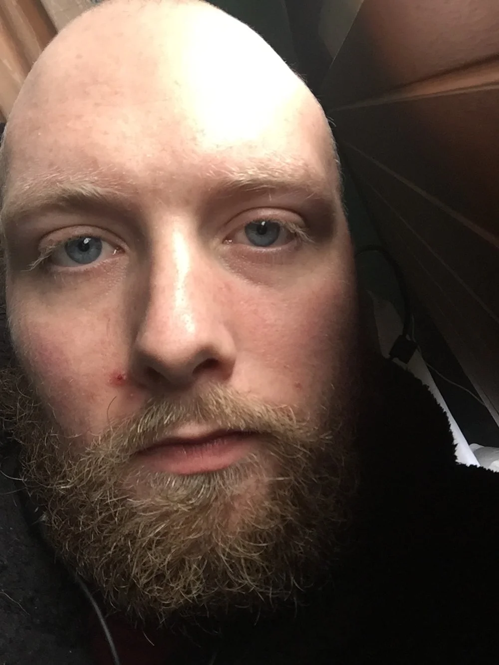 Close-up of a man with light skin, blue eyes, a beard, and some redness on his face, lying down with a portion of his head resting against a wooden surface.