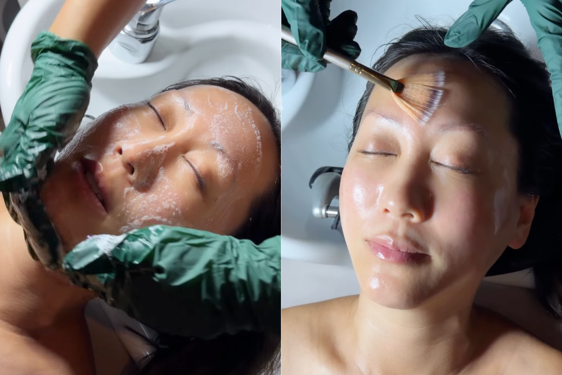 The Glass Skin Treatment Is a Glow Up with No Downtime