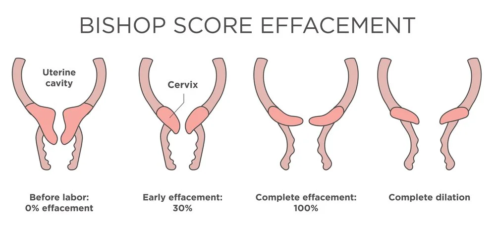       
  
    The Amazing Steps your Cervix takes in Labour  Many pregnant people hear stories of long labours. Especially in first time parents. Heading to the hospital to get checked, to be told they are “only” 1cm dilated.&nbsp;This blog will expl