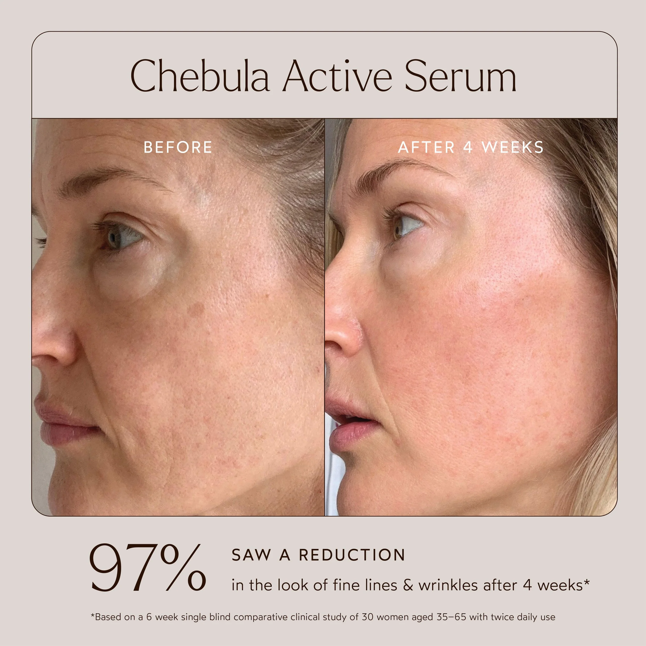 Retail Resize Before & Afters 1-05.jpg