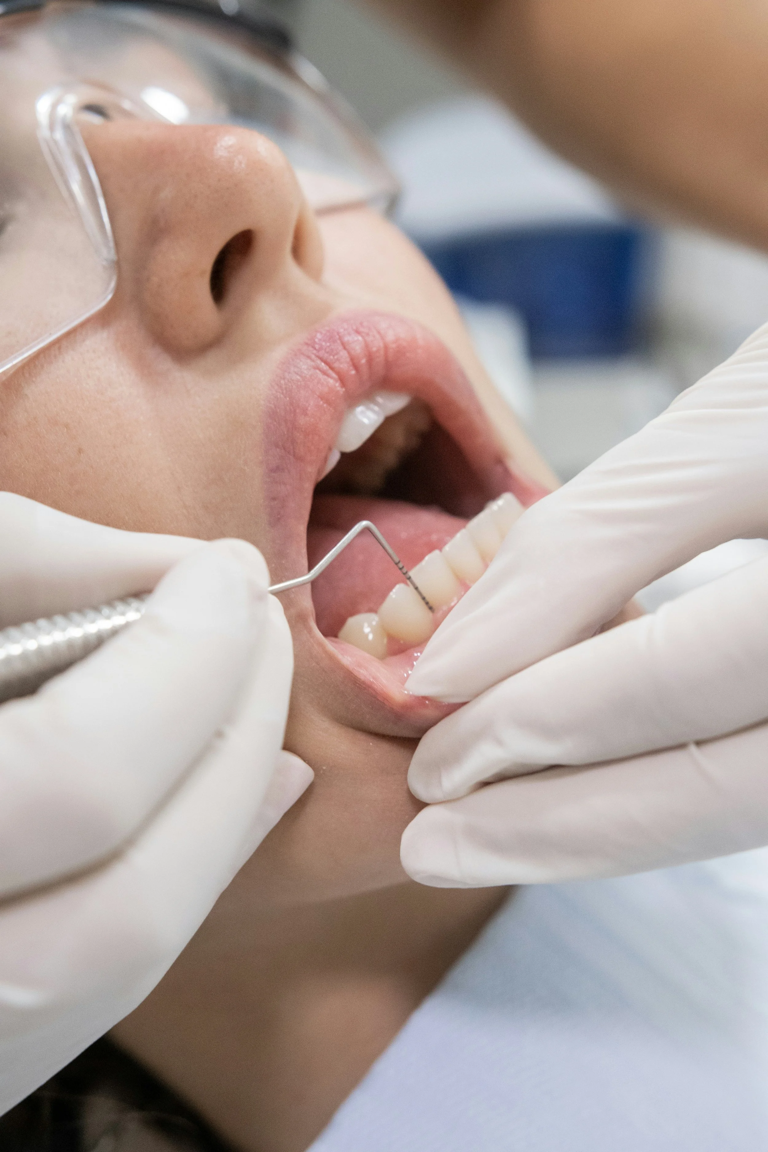 Unexpected Symptoms of Gum Disease 