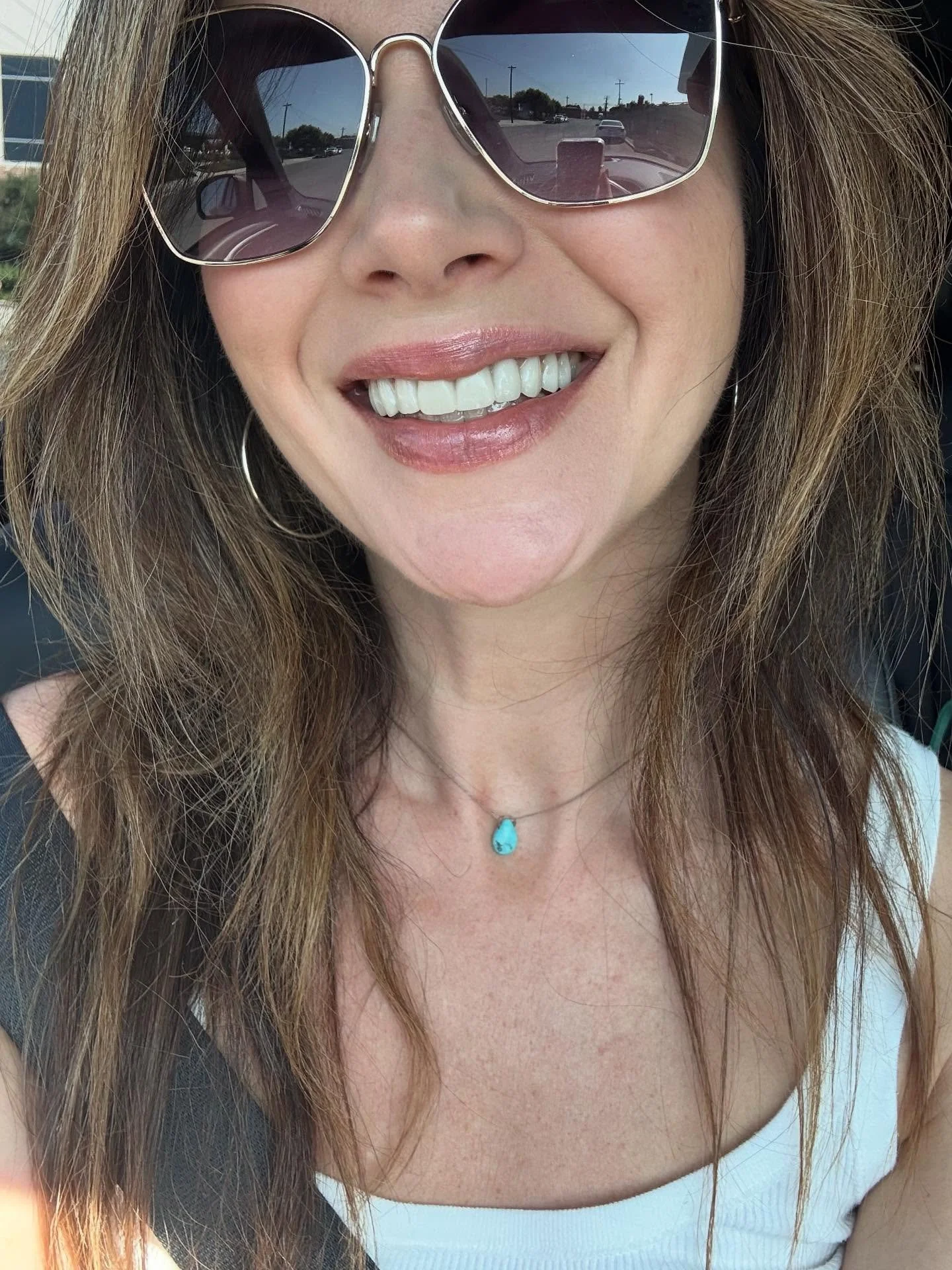 Our gorgeous patient and friend @sabrinakozachuk looking confident in her beautiful new temporary veneers. Stay tuned for two weeks from now when she gets her permanent porcelain veneers! 

Looking to upgrade your smile in time for the holidays? Give