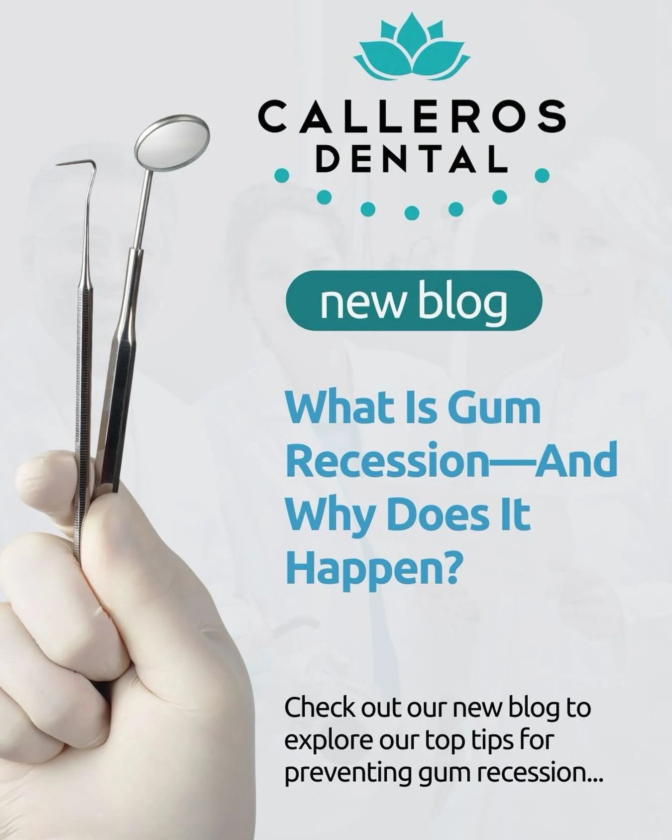What is gum recession and is it preventable? Gum recession occurs when the soft tissue around your teeth starts to pull back, exposing more of the tooth surface (or even the root). 
#LinkInBio to DrCalleros.com/blog for our top tips&hellip;

#newblog