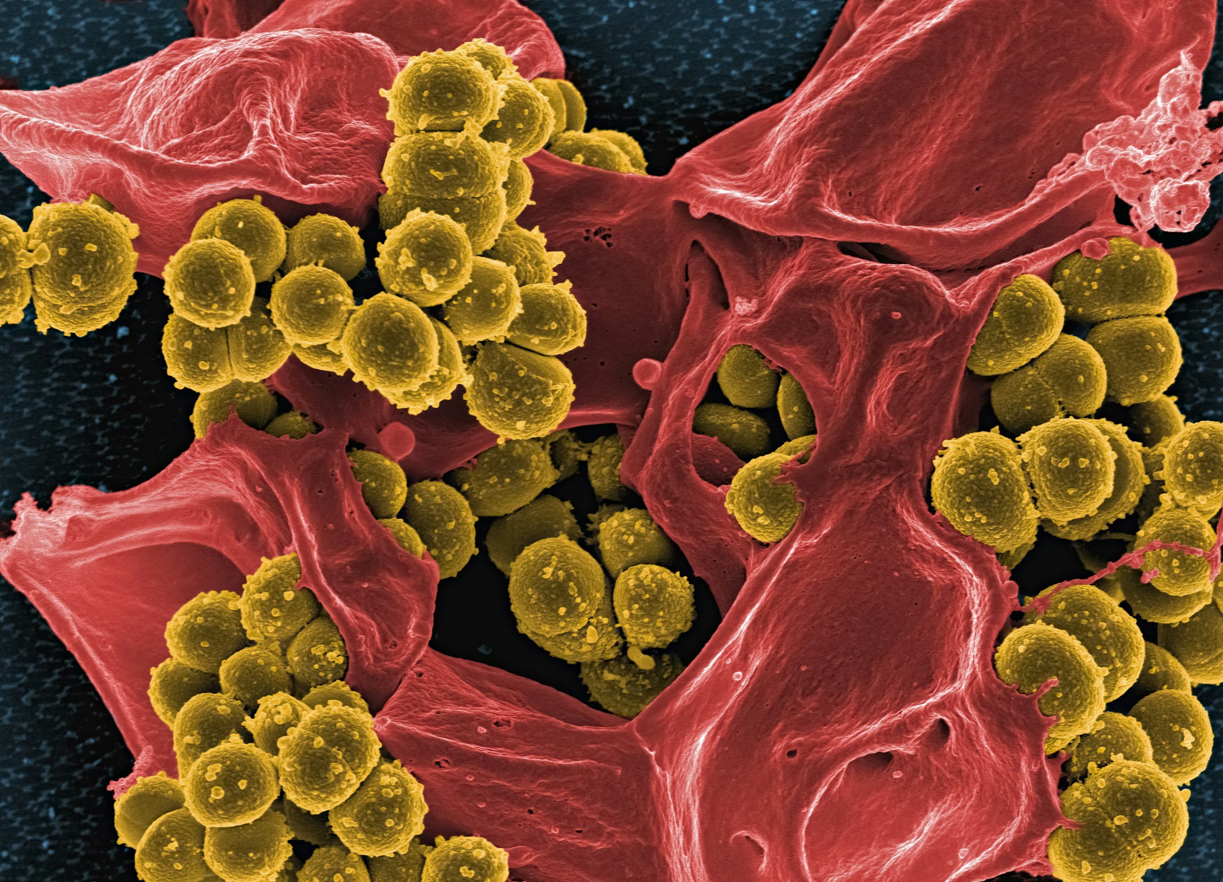 graphic depicting bacteria