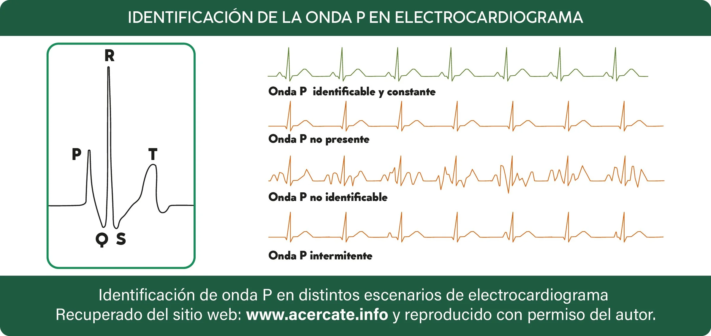 generico_ondaP_escenarios.jpg