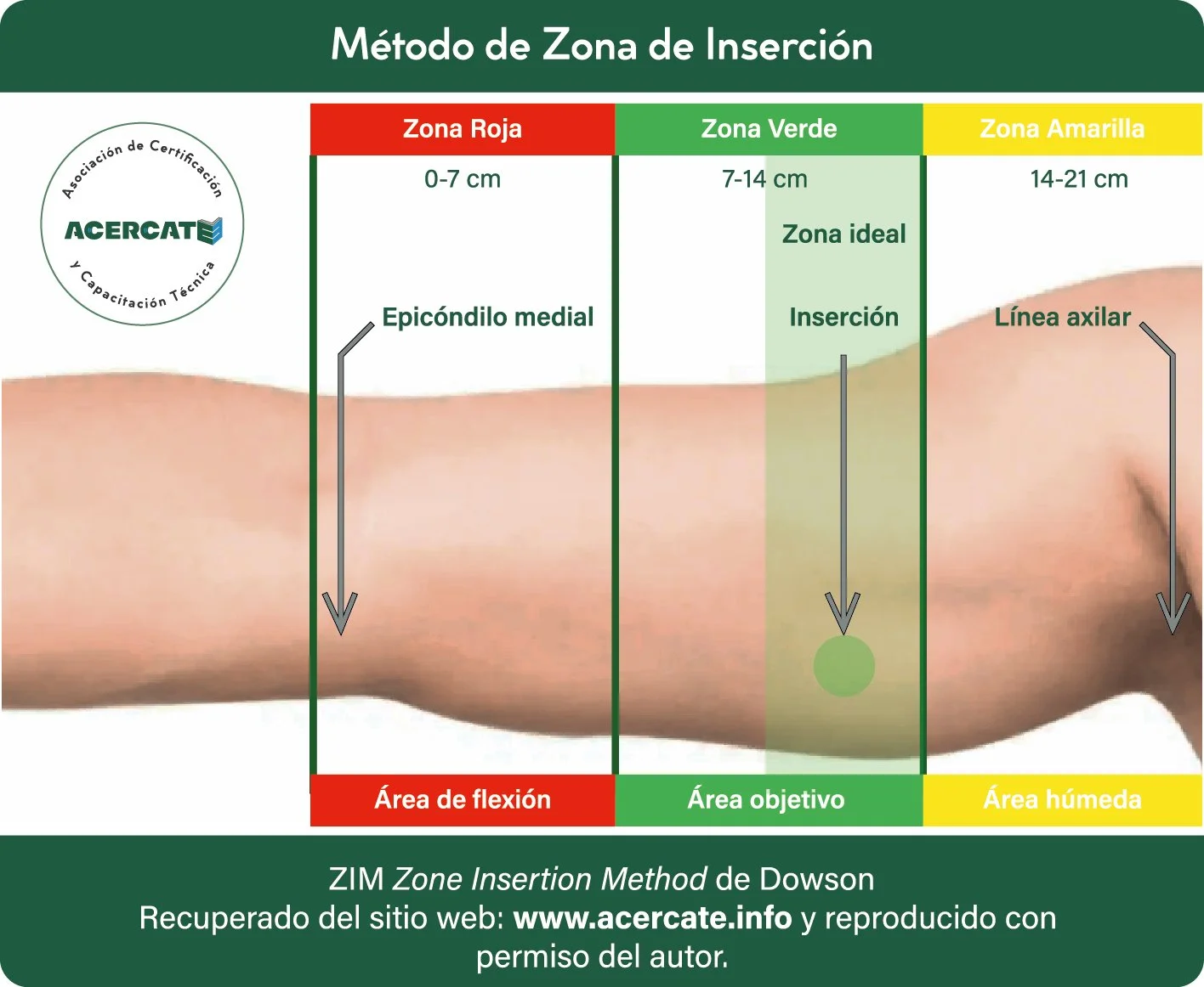 área ideal de inserción