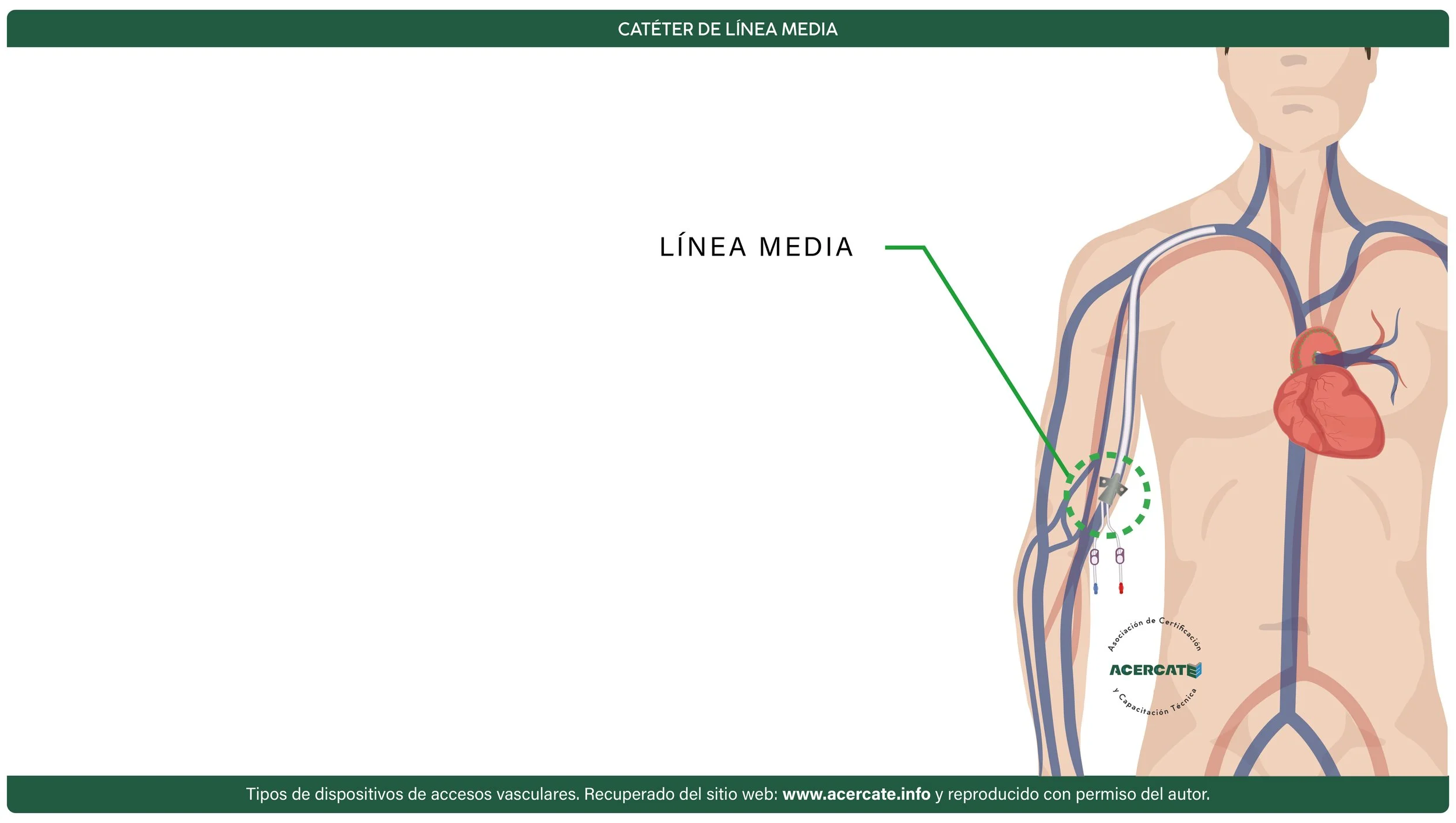 linea media slide.jpg