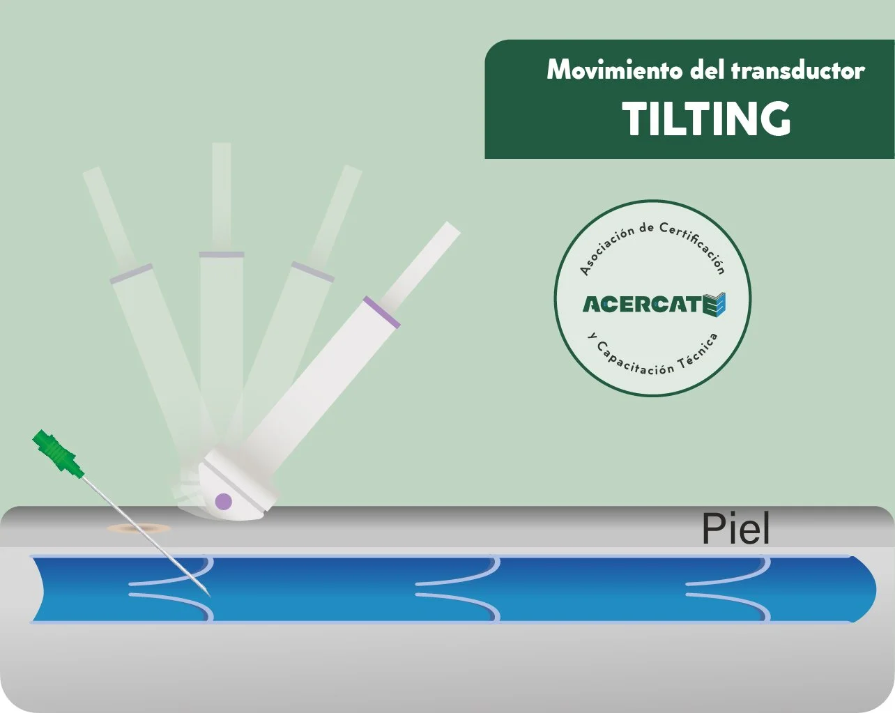 generico_transducer_verdetilting.jpg