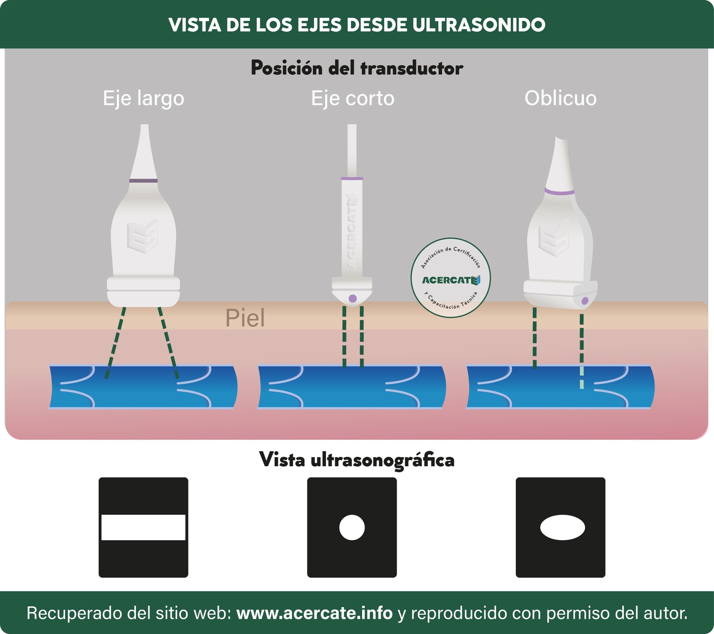 generico_ejesdeultrasonido.jpg