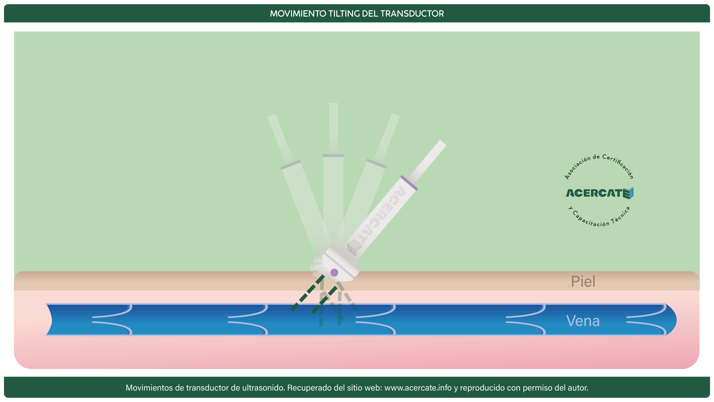 movimiento tilting horizontal.png