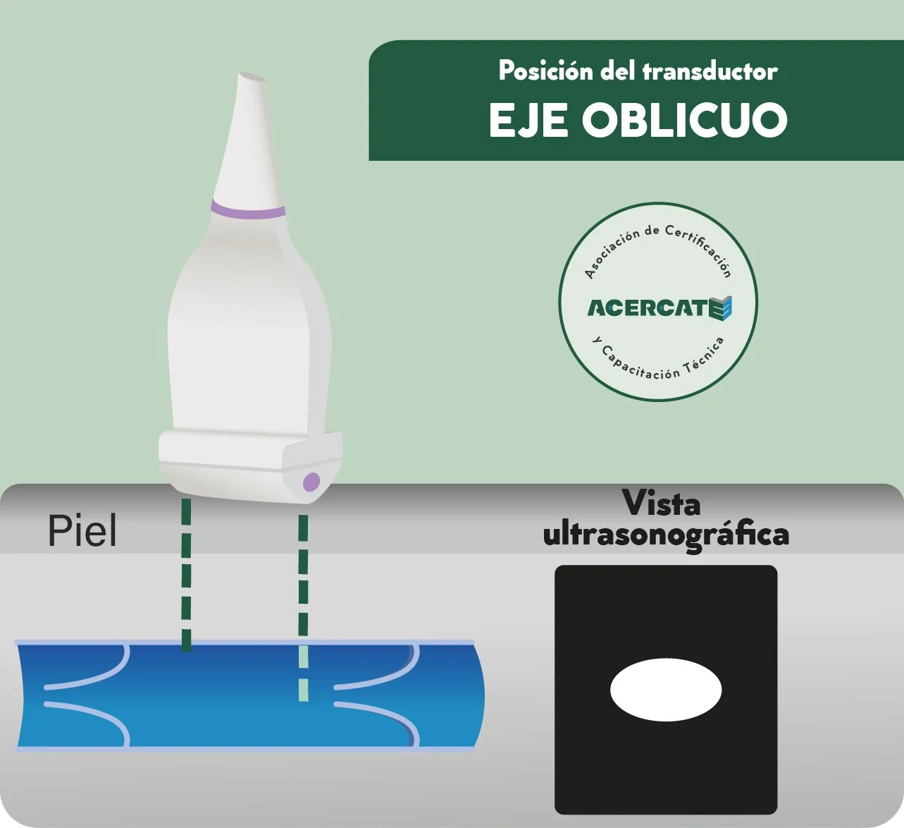 generico_transducer_verde_ejeoblicuo.jpg