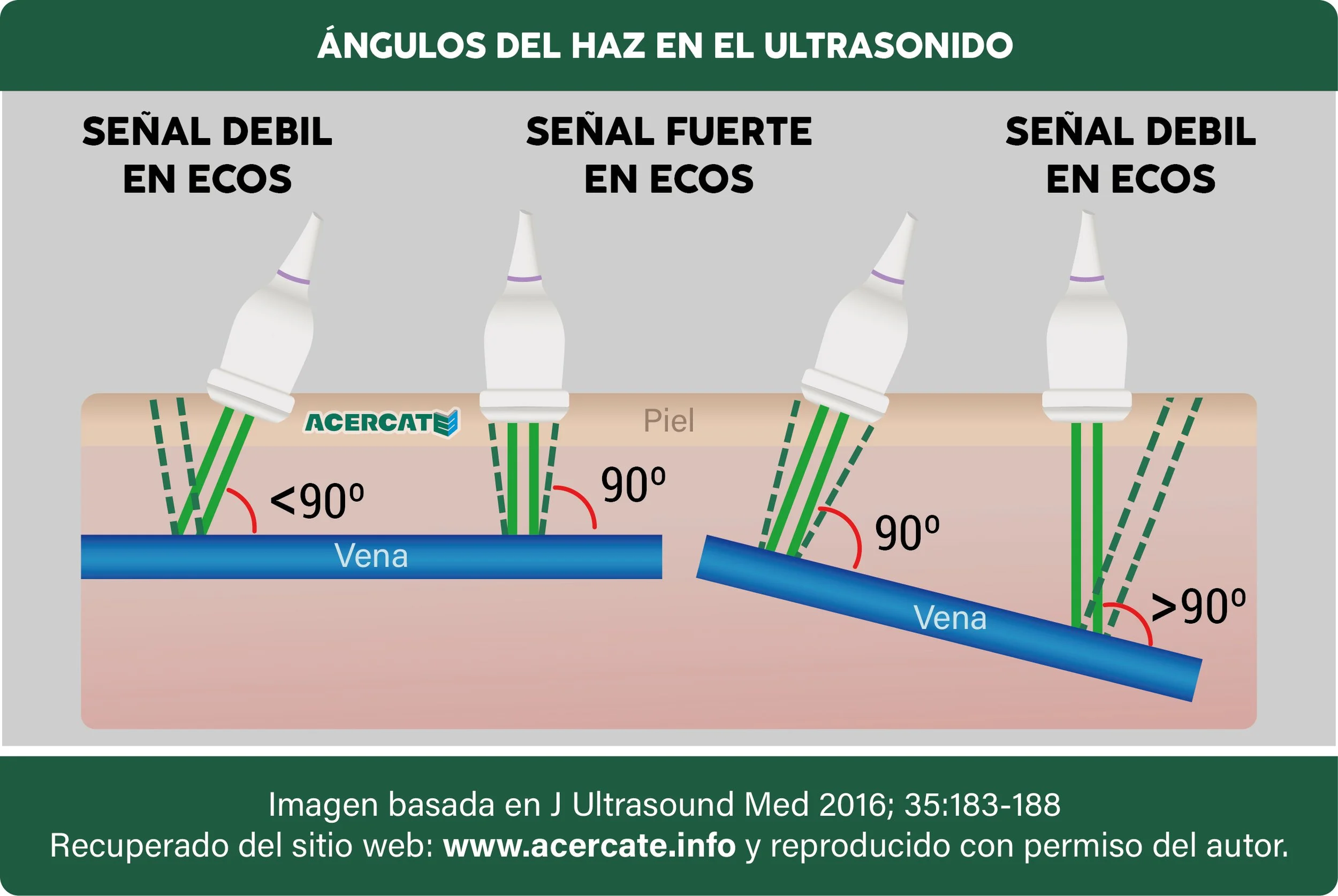 generico_haz_de_transductores.jpg
