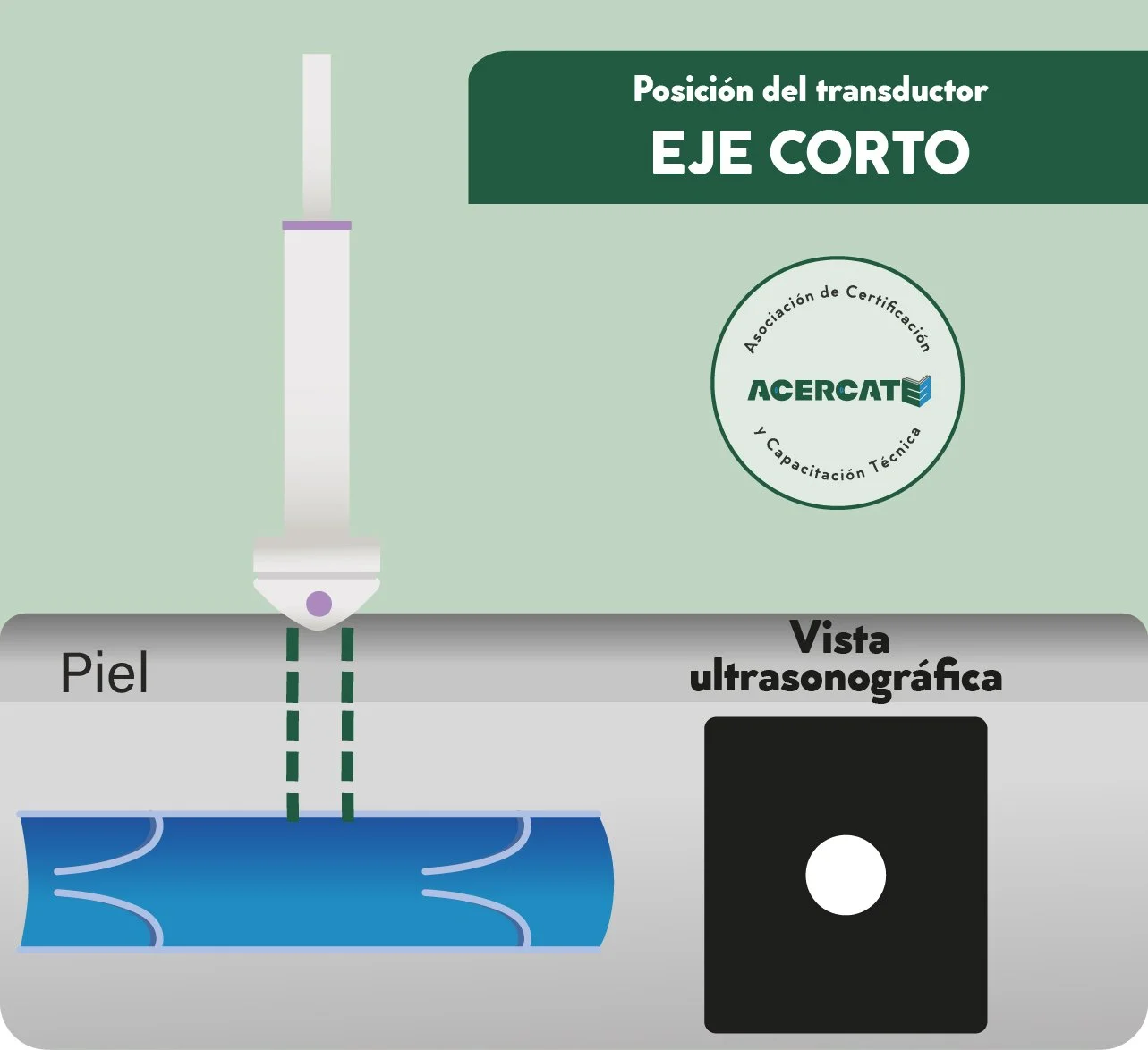 generico_transducer_verde_ejecorto.jpg