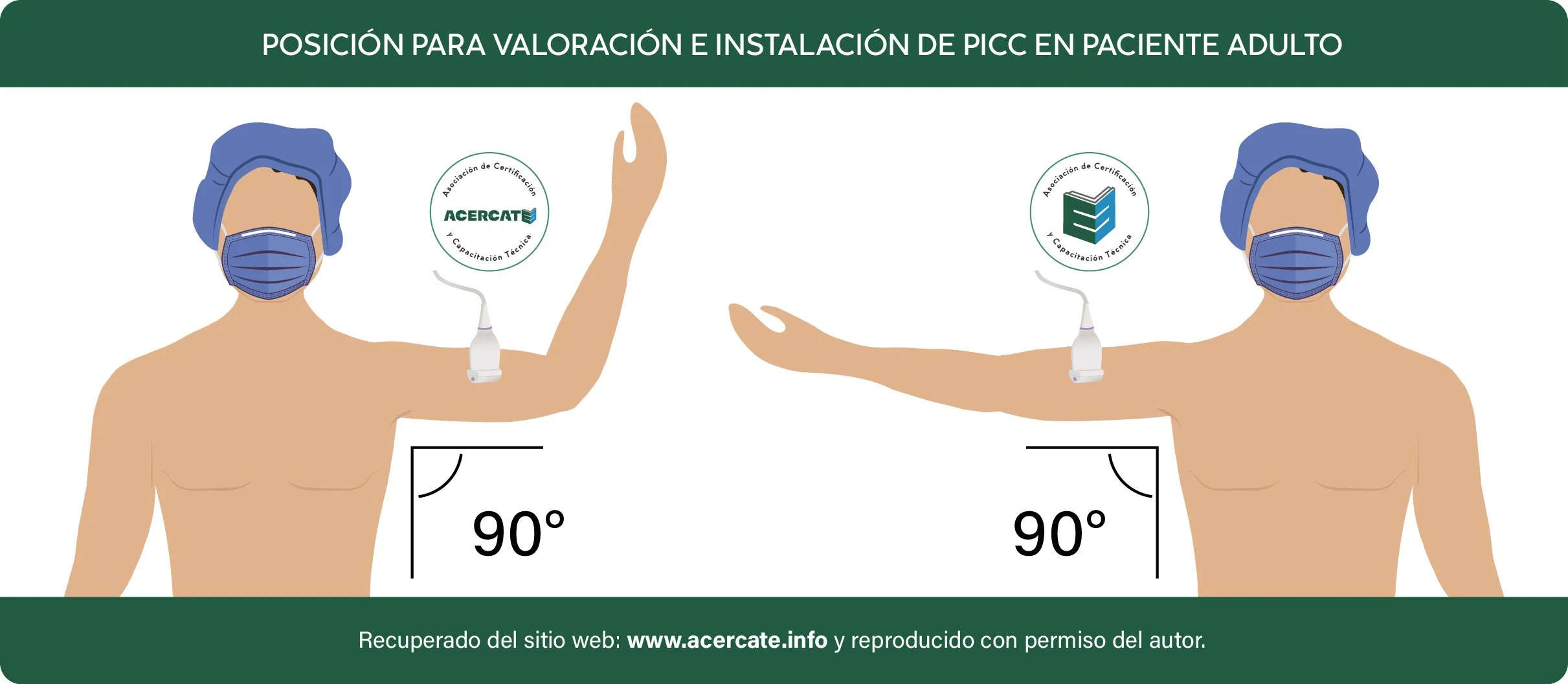 Posibles posiciones de brazo del paciente para la valorazión con ultrasonido.