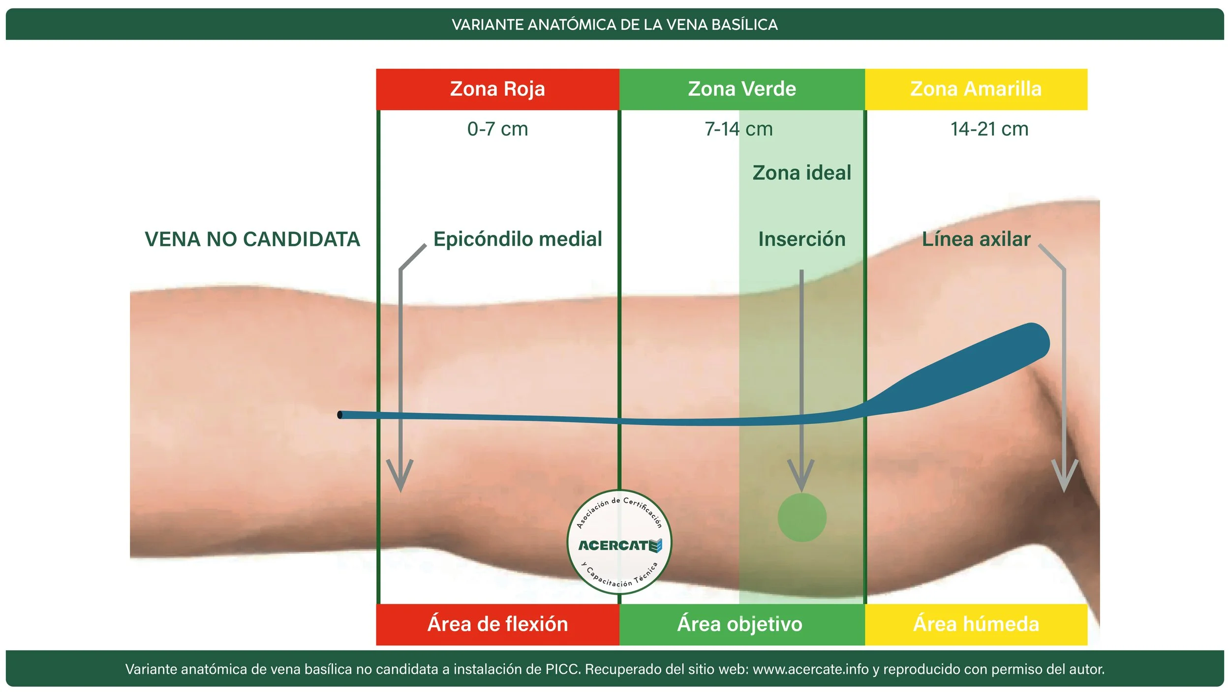 vena no candidata.jpg