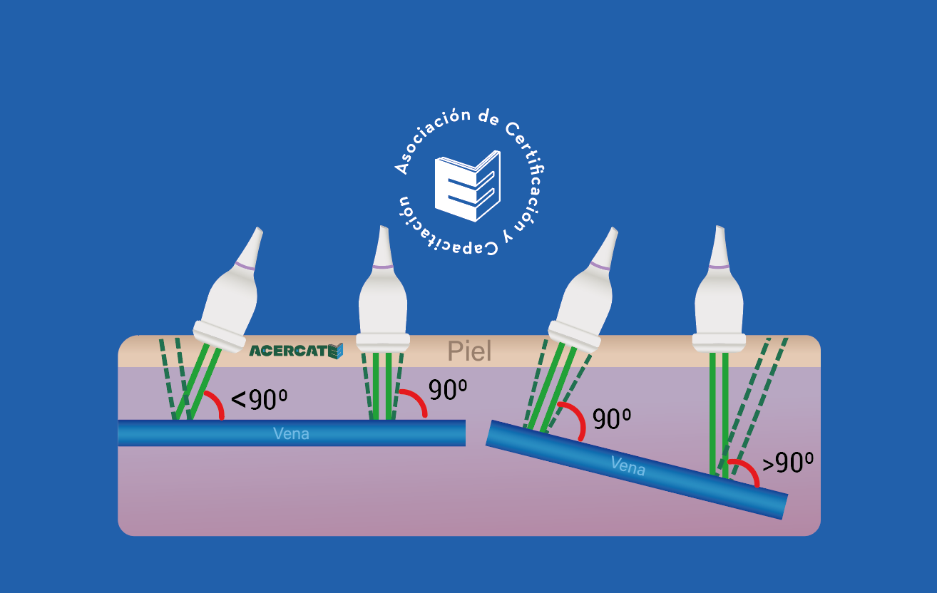 Técnicas de Manejo del Transductor