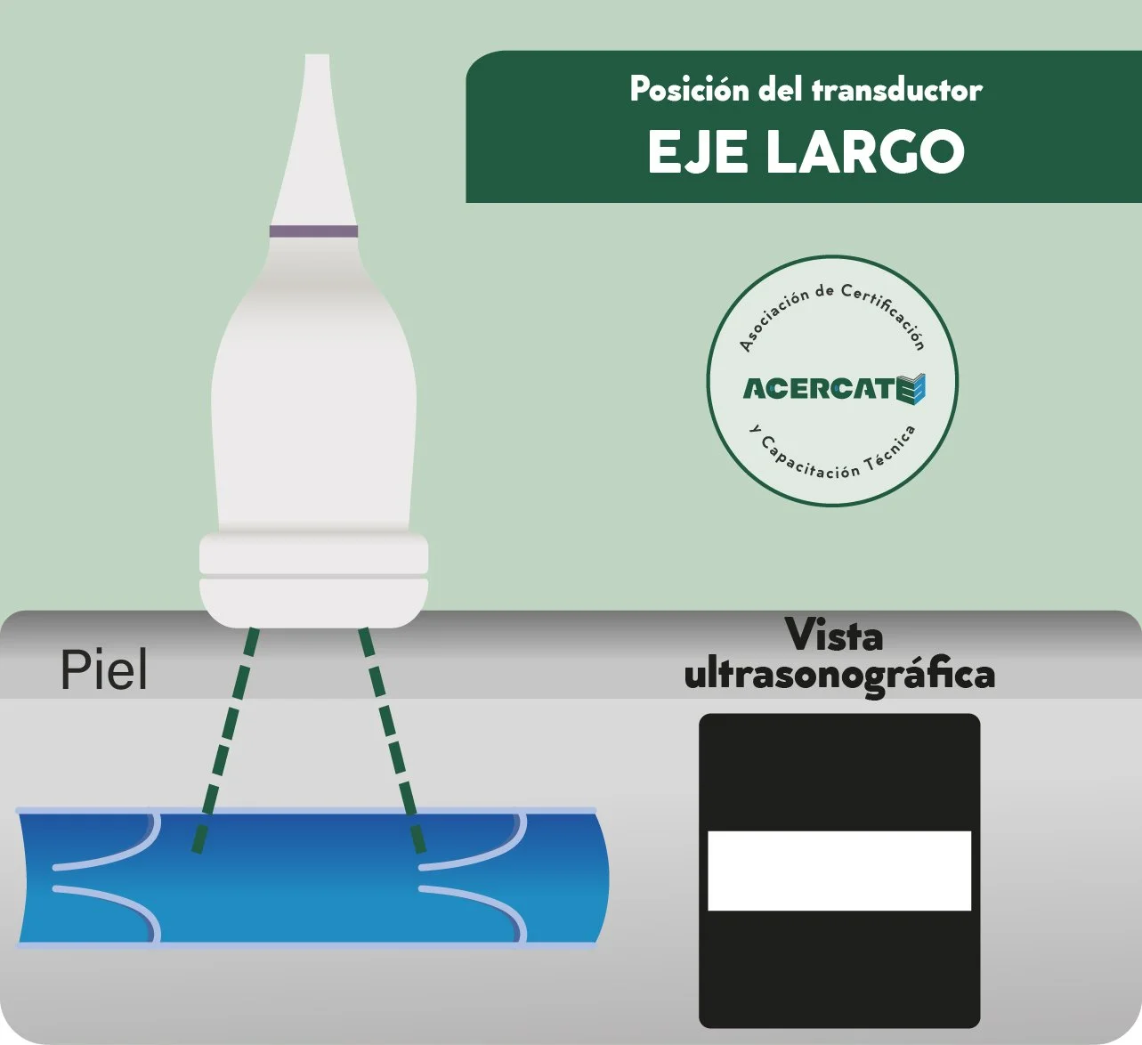 generico_transducer_verde_ejelargo.jpg