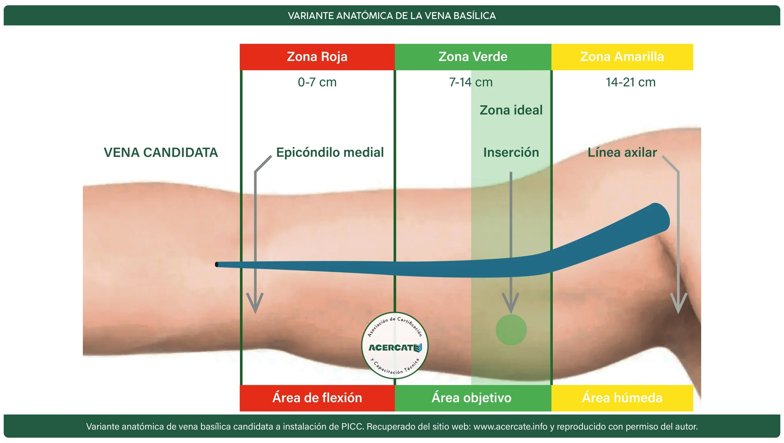 vena candidata .jpg