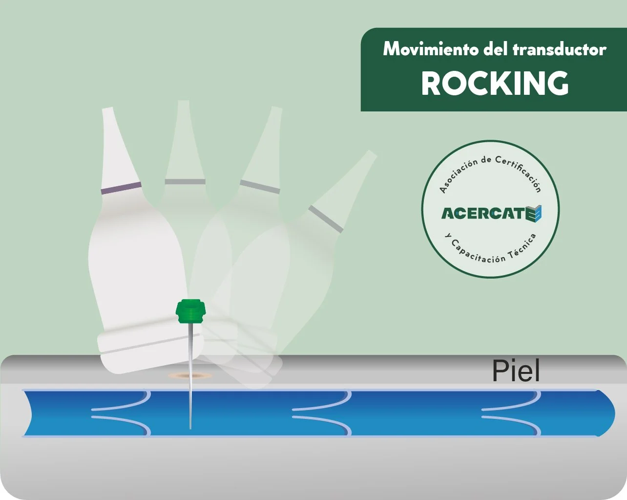 generico_transducer_verderocking.jpg