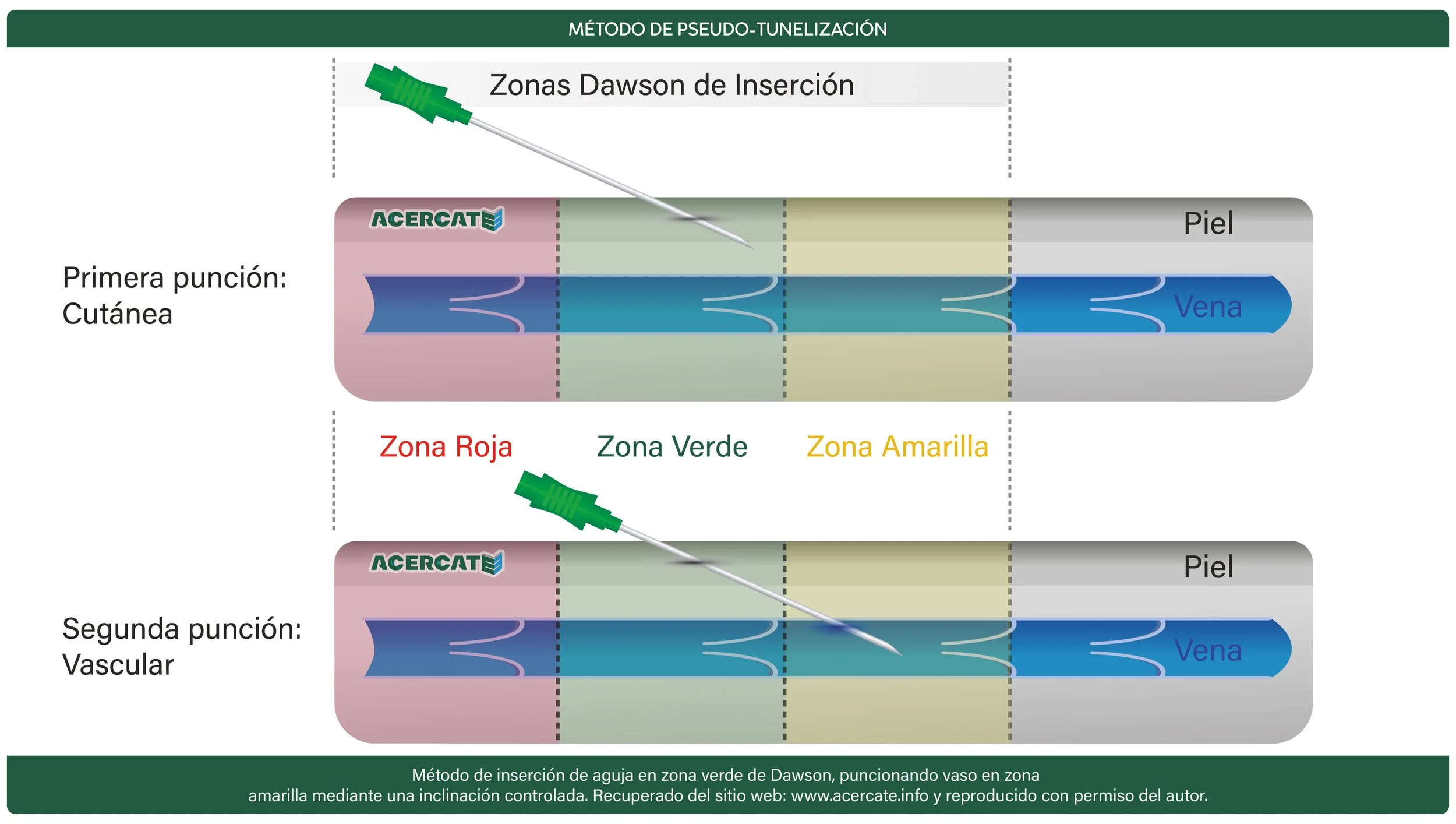 pseudo explicacion.jpg