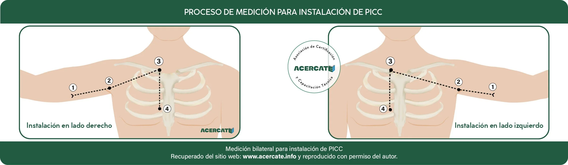 generico_medicion_bilateral.jpg