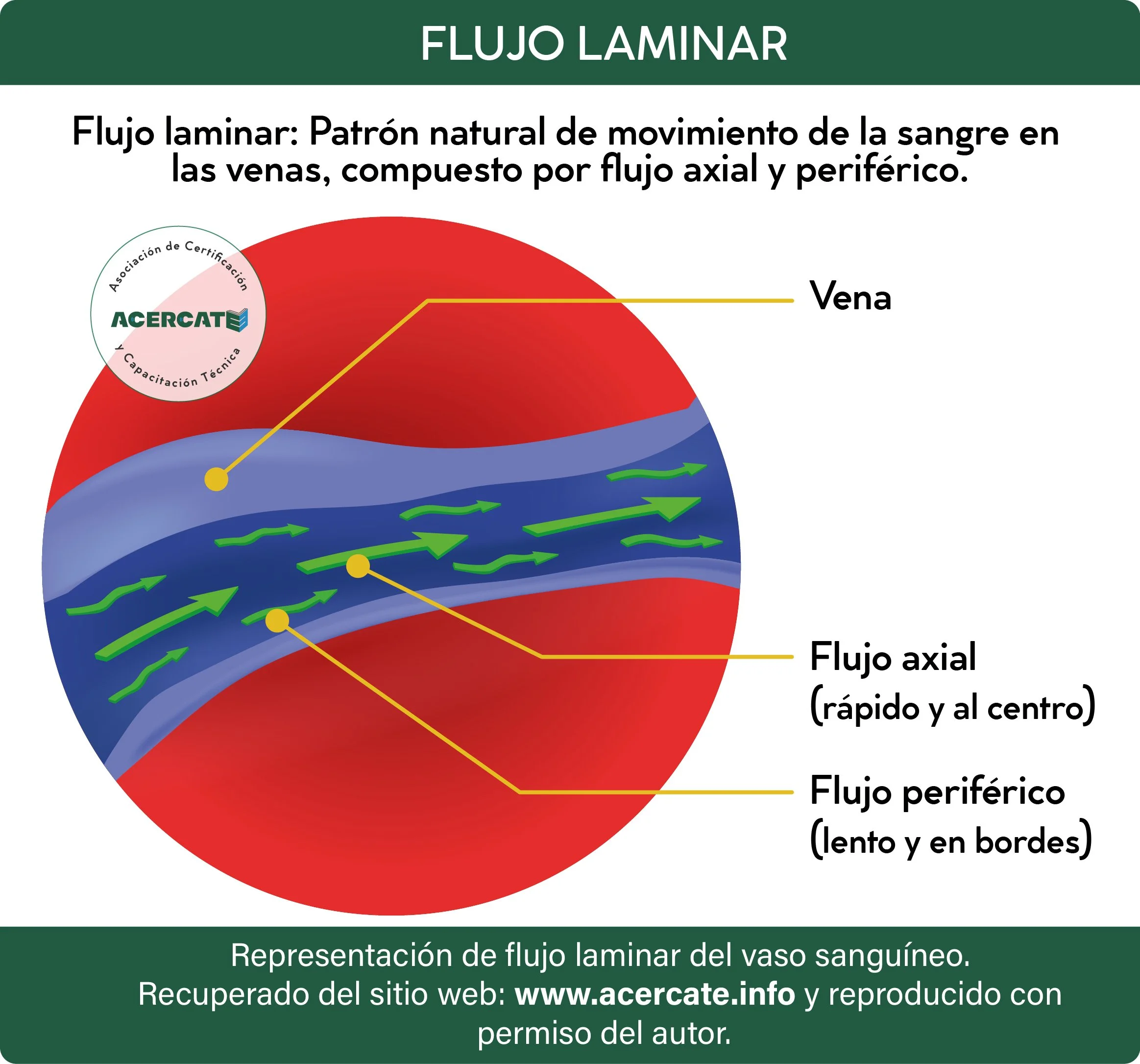 generico_flujo_laminar.jpg