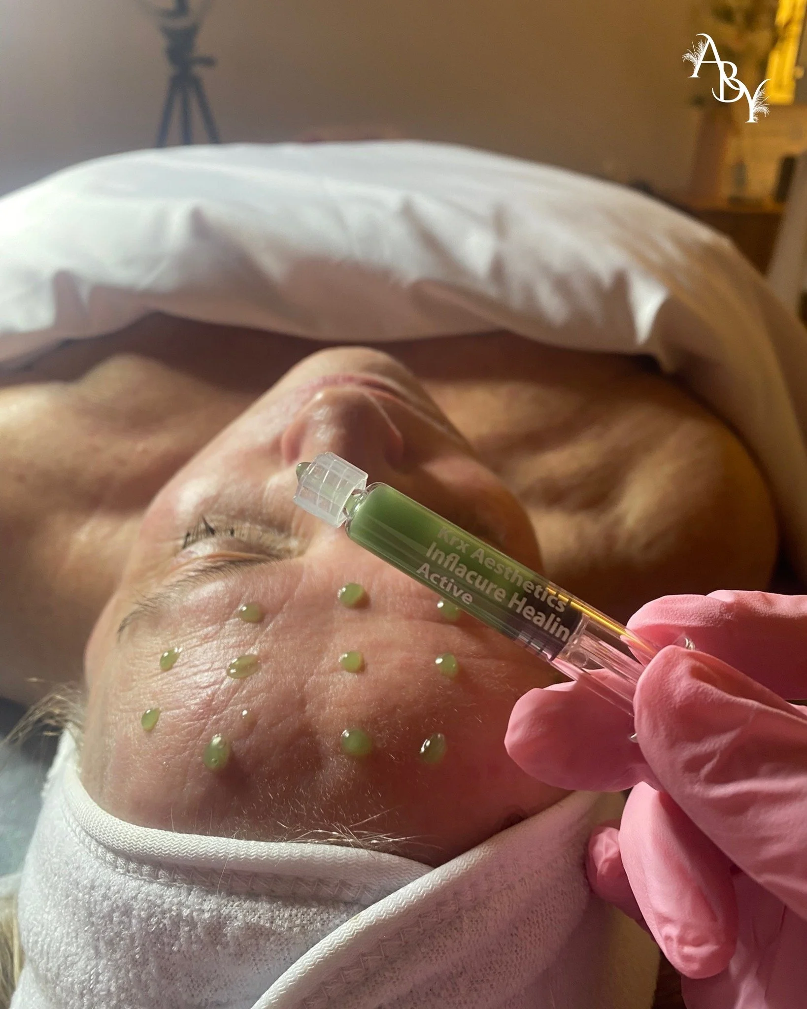 Not every facial is about exfoliating, sometimes your skin needs calming, repairing, and restoring 🤍

KRX Inflacure is a professional calming treatment I use when skin is:
✨ Inflamed
✨ Over-exfoliated
✨ Breaking out
✨ Post-procedure
✨ Barrier-compro