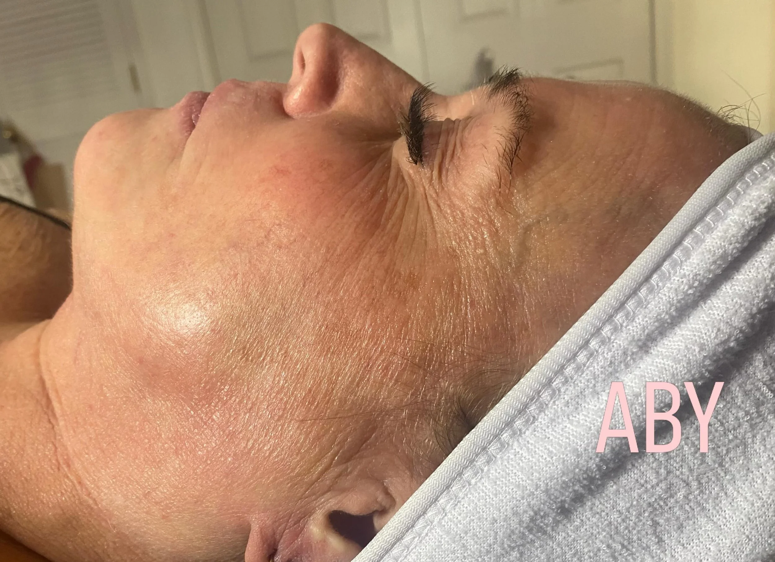 ✨ Texture. Glow. Renewal. ✨

Today&rsquo;s treatment featured ✨Green Sea Peel Liquid Microneedling✨ combined with the ✨Gold Peptide Meso Booster✨ for next-level glow and skin renewal. 🌿💛

This advanced Korean skincare treatment helps:
▫️Stimulate c