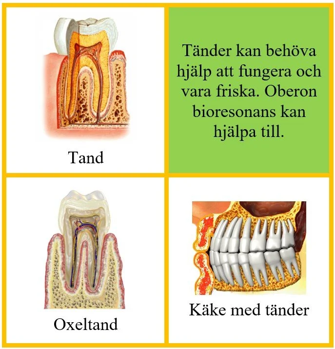 Tänder.jpg