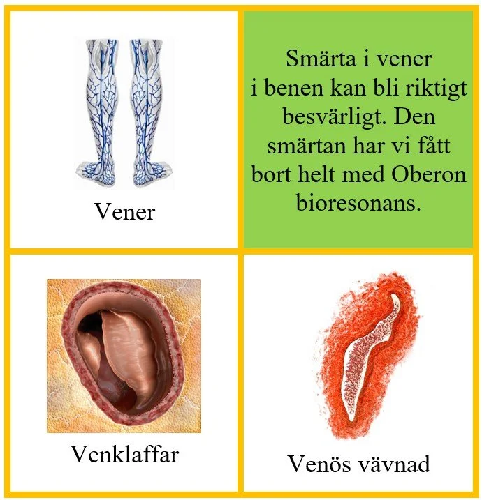 Vener.jpg