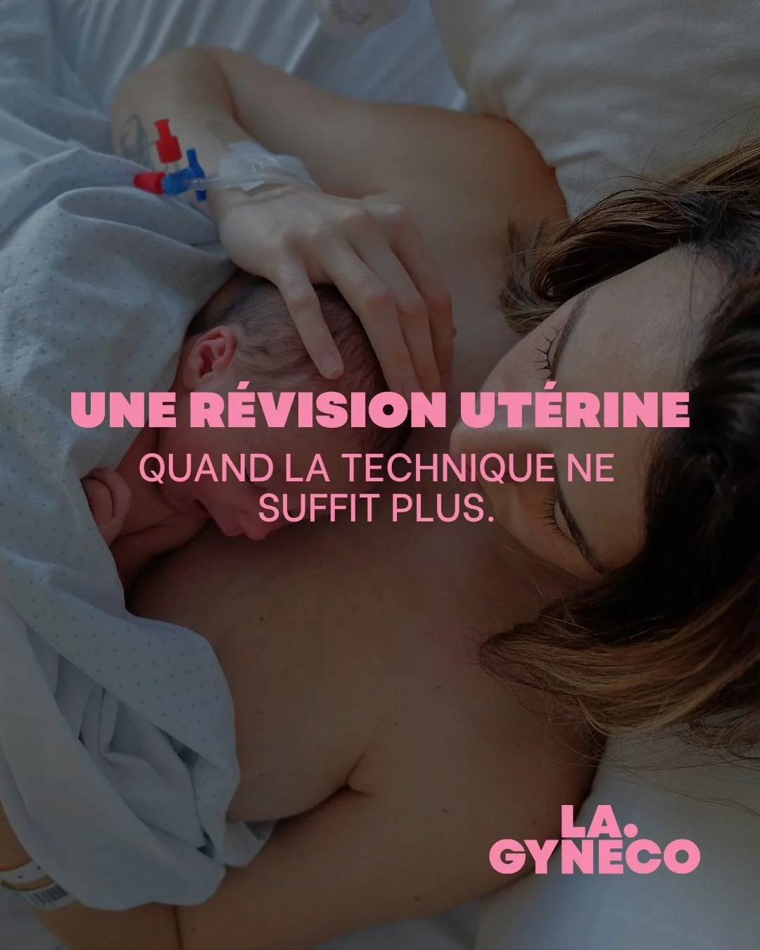 Ce texte est un t&eacute;moignage.
Il parle d&rsquo;un geste r&eacute;el, n&eacute;cessaire, parfois vital, et de ce qu&rsquo;il engage pour celles qui le re&ccedil;oivent comme pour celles et ceux qui le pratiquent.

Il concerne 2-3% des accouchemen