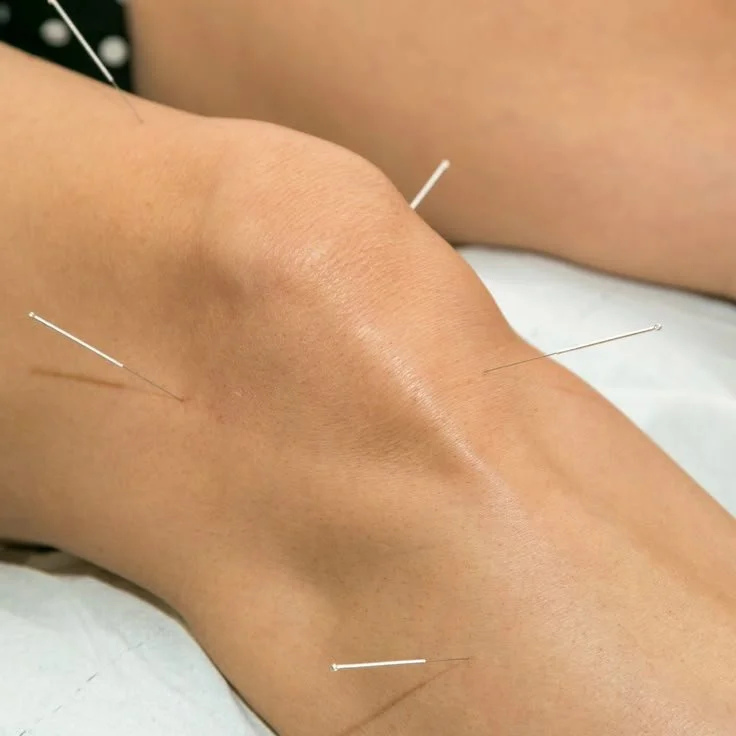 Hit the Trails Without the Pain: Acupuncture for Hikers' Knees