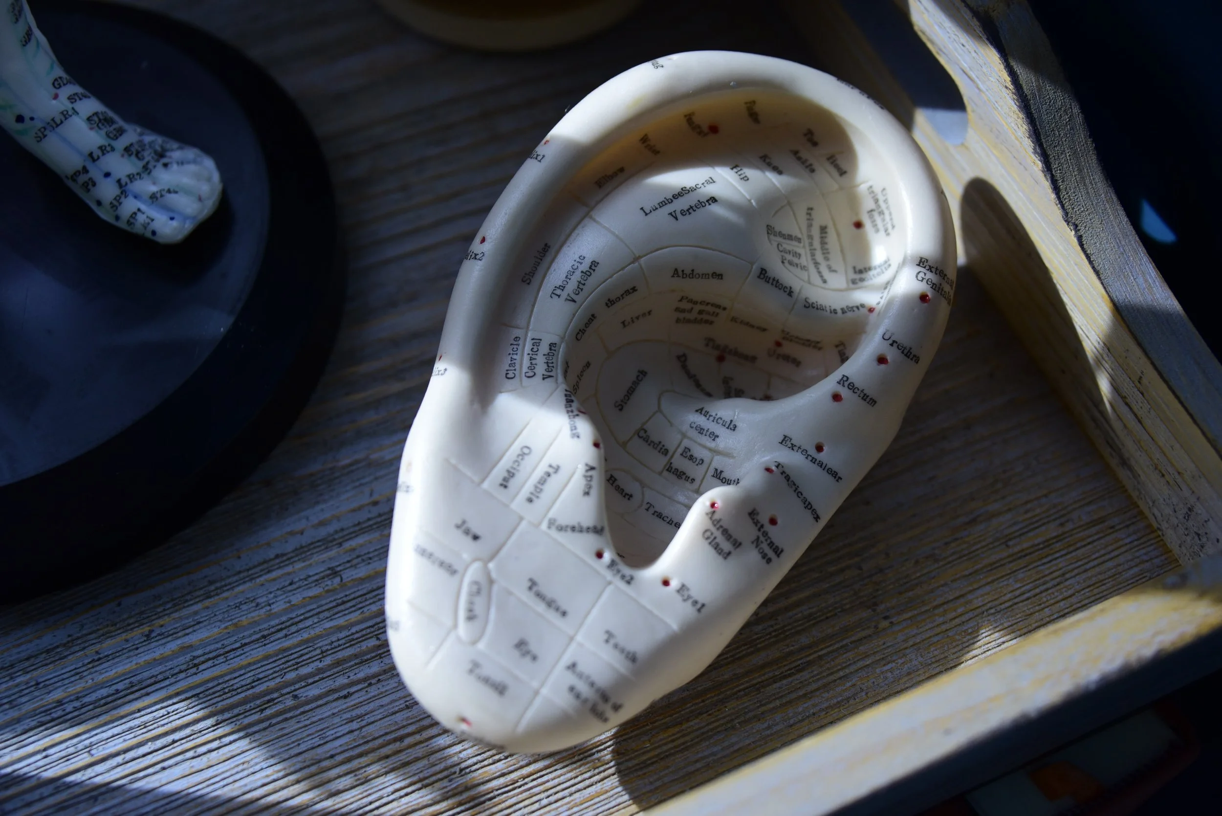 Cupping, Acupuncture, Electroacupuncture, Moxa, and Dry Needling: What's the Difference?