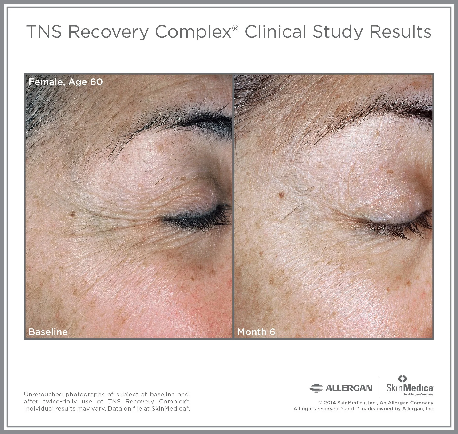 TNS_RC_CS_Female_Age60.jpg