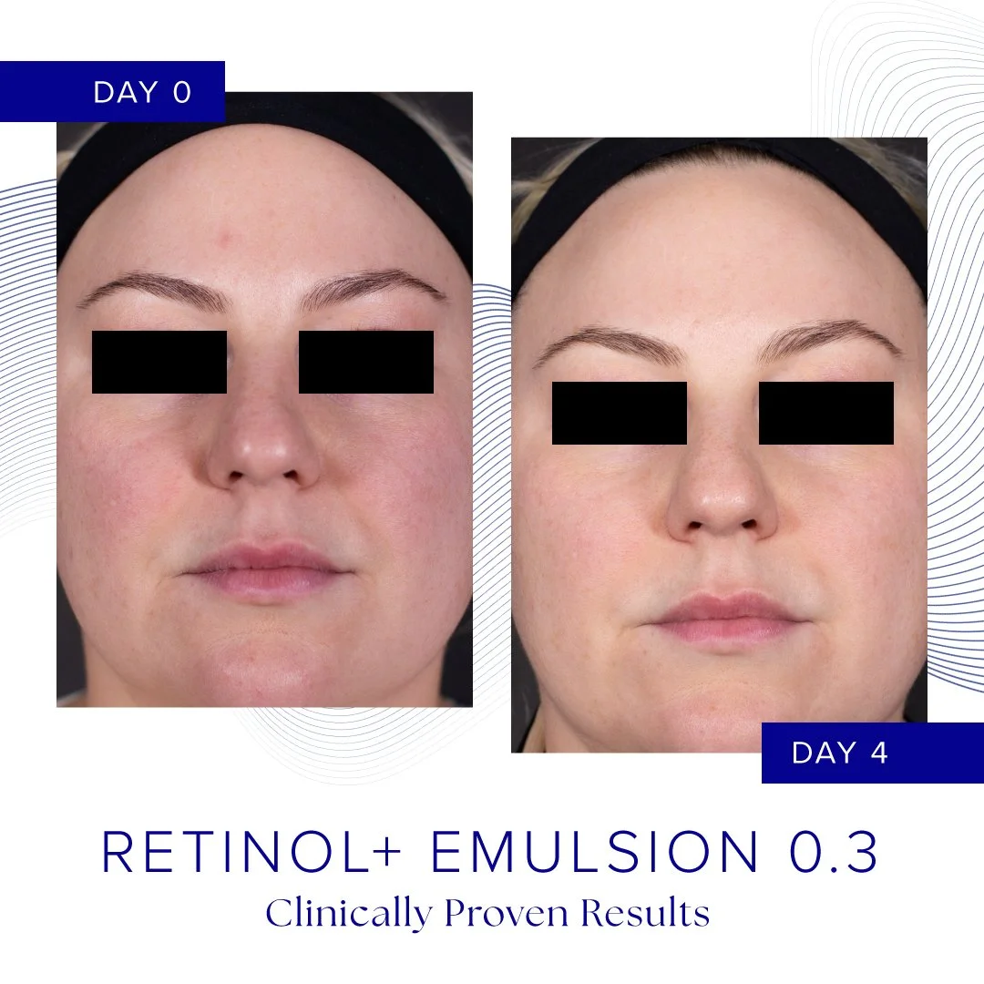 B A_Retinol_results_square_3.jpg