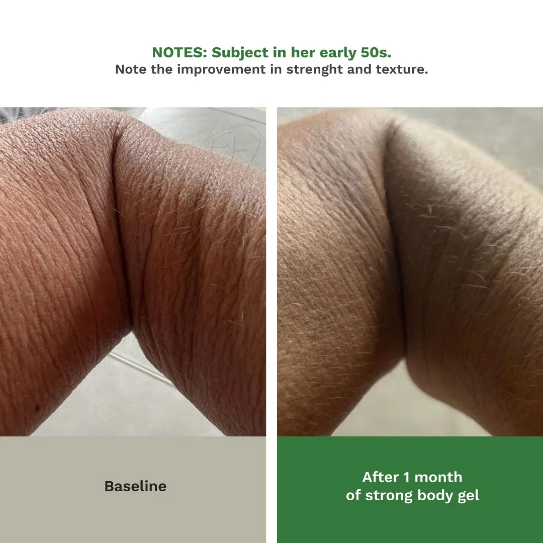 7_body_before_after.jpg