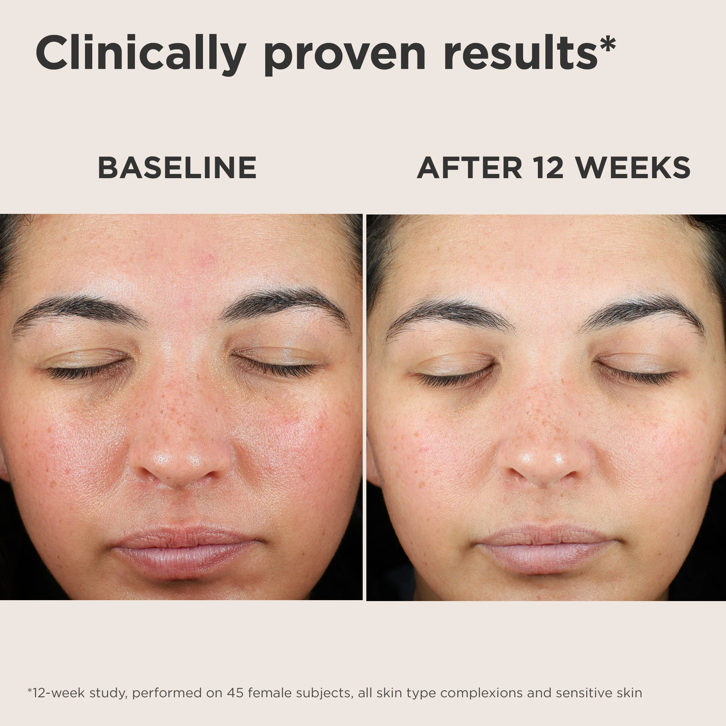 UV Skin Recovery Untinted(2).jpg