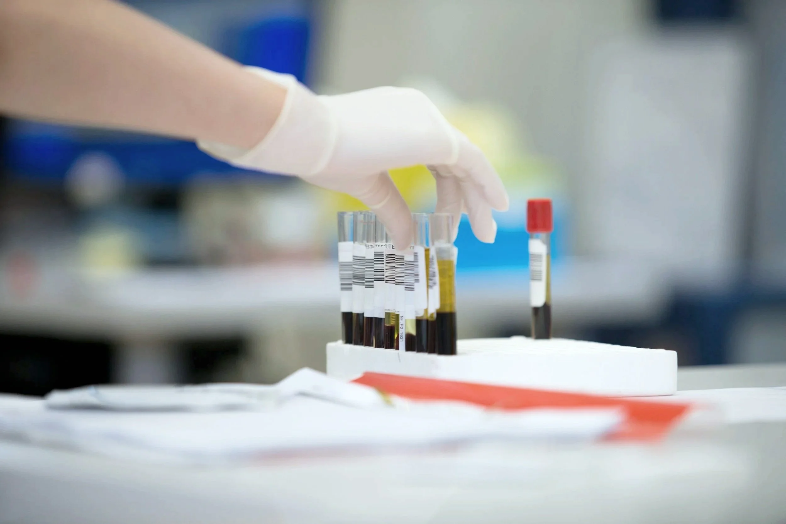Ein Arzt handhabt Teströhrchen mit Blutproben in einem Labor. Die Person trägt Handschuhe.