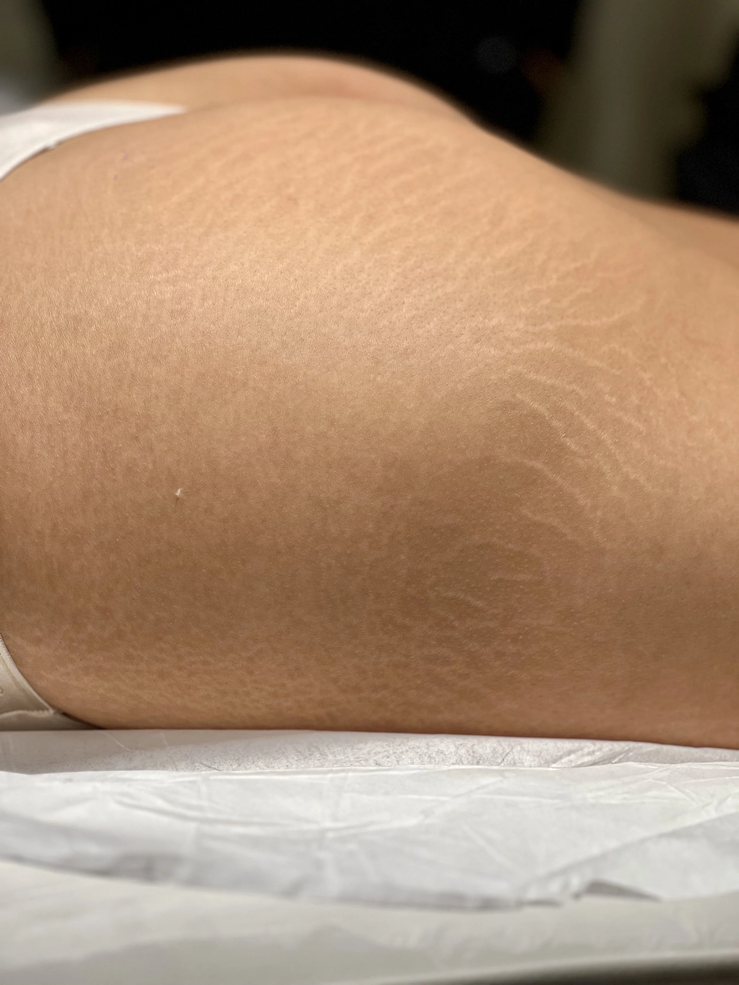 Close-up of a person's thigh with smooth, light skin and subtle skin texture, resting on a white surface.