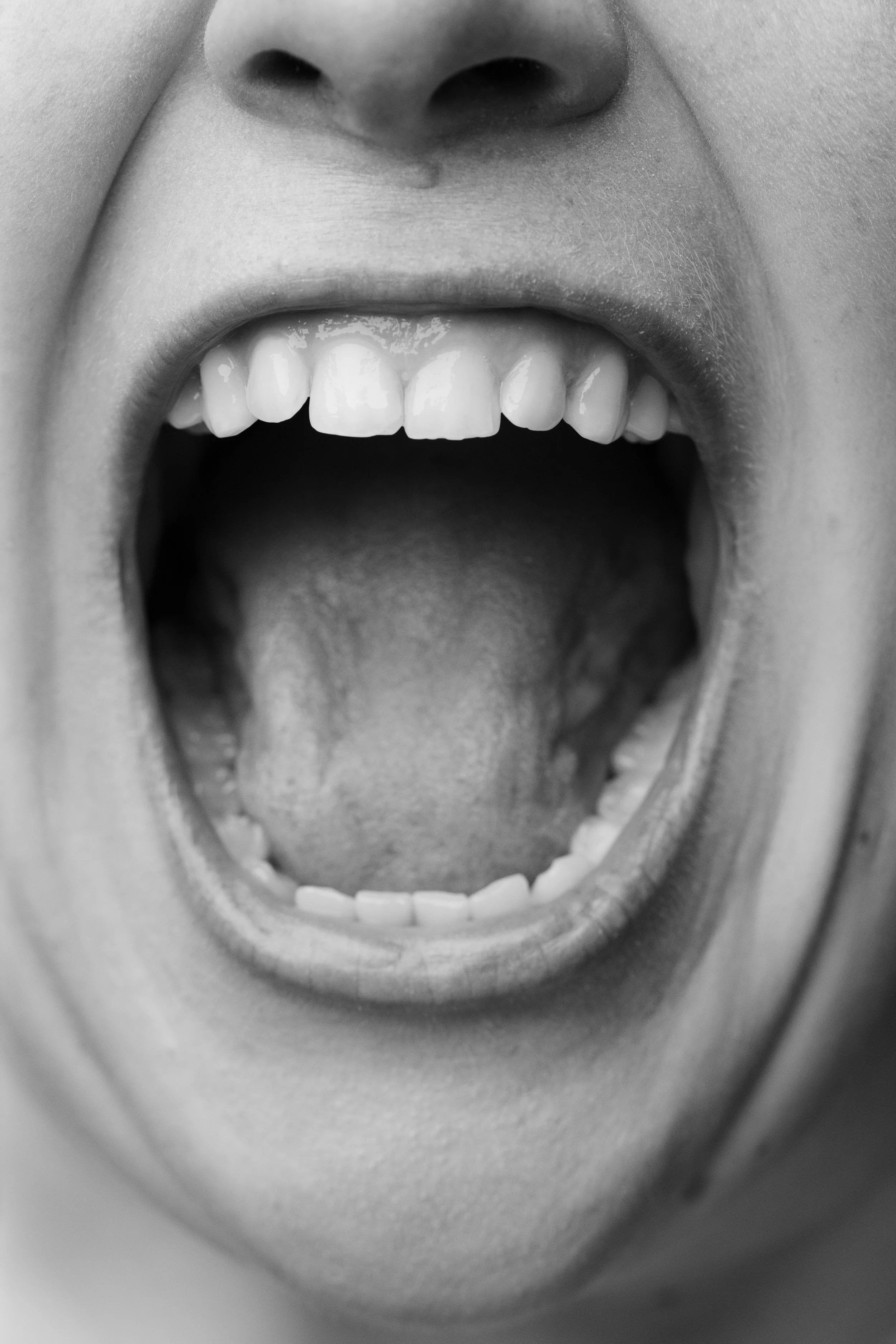 Close-up of a person with their mouth wide open, showing teeth and tongue.